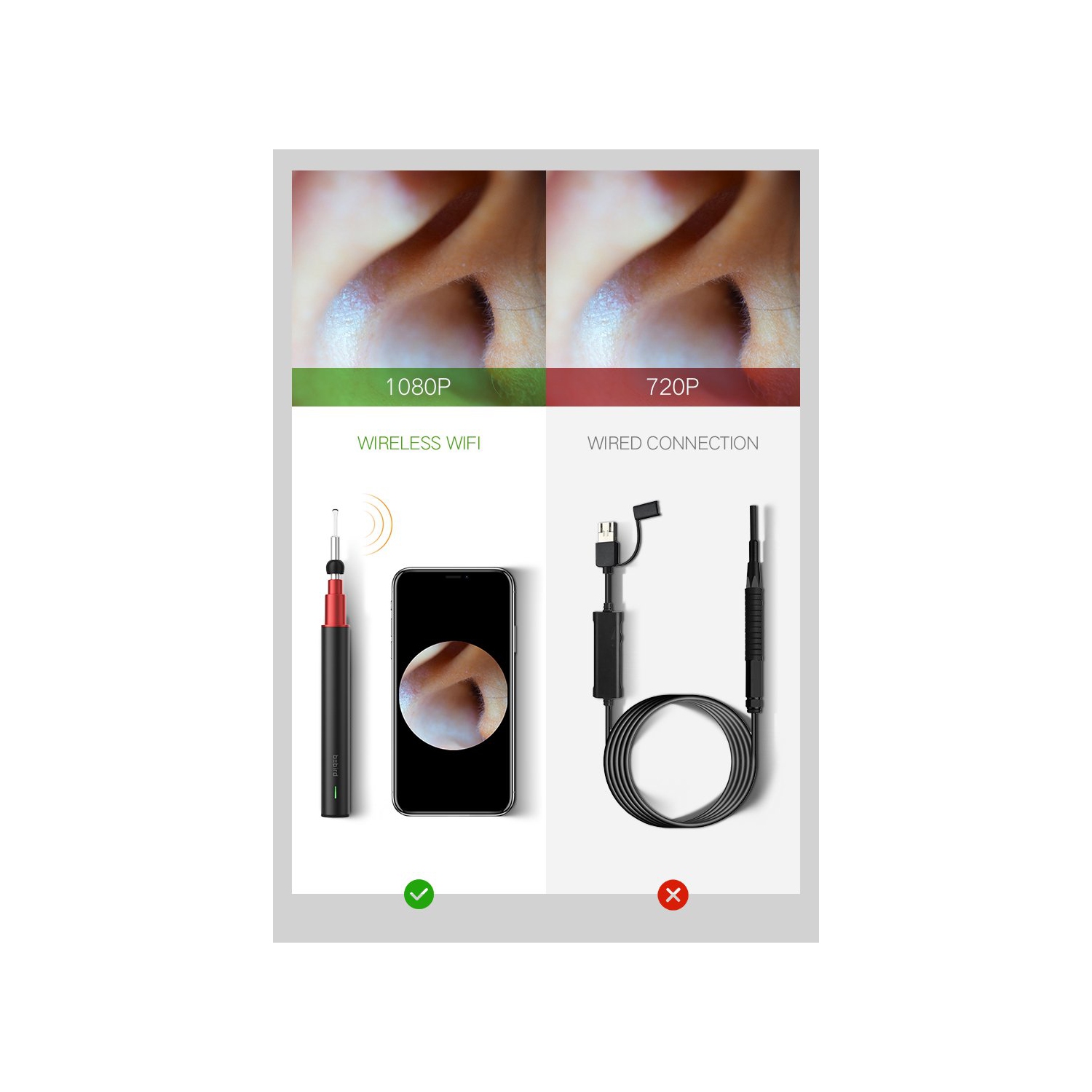 BEBIRD A2 Otoscope intelligent visible couleur argentée