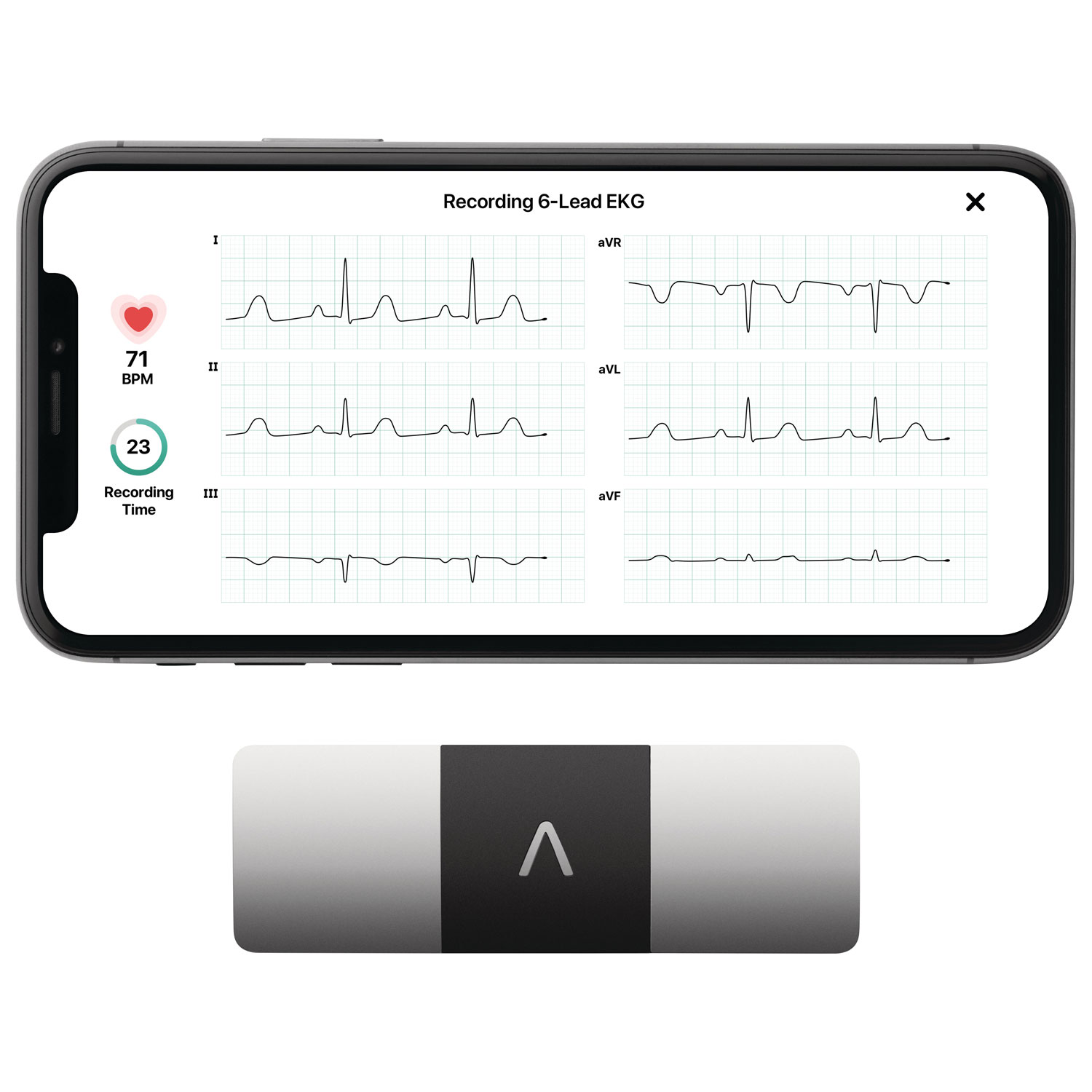 Moniteur d'ECG portatif KardiaMobile 6L
