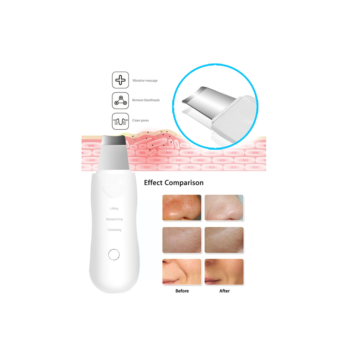 ISTAR Ultrasonic Skin Scrubber Spatula, Blackhead Remover Pore Cleaner with 4 Modes, Facial Scrubber Spatula, Comedones Extractor for Facial Deep