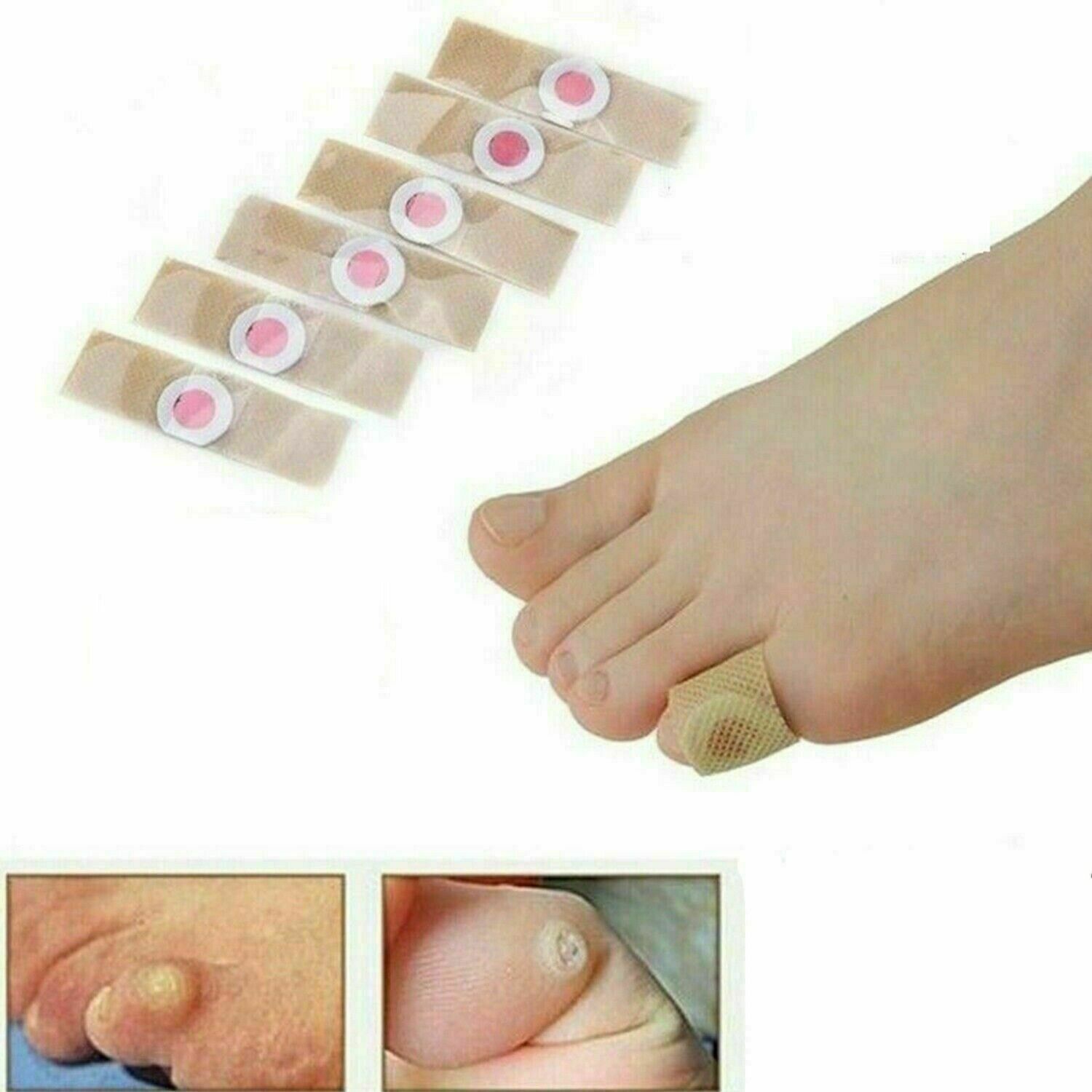 6Pcs Box Foot Corn Removal Plaster with Warts Thorn Patch Soften Skin Sticker