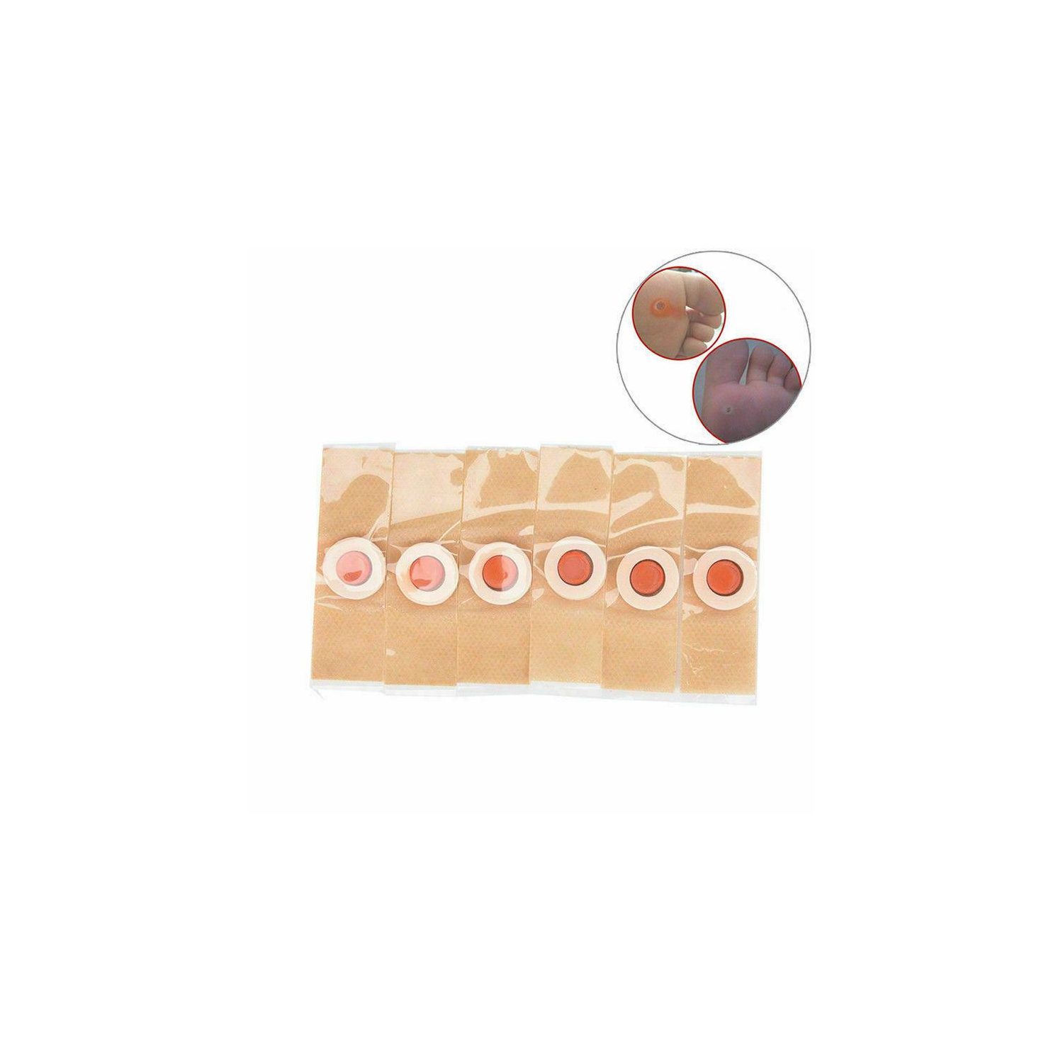 6Pcs Box Foot Corn Removal Plaster with Warts Thorn Patch Soften Skin Sticker
