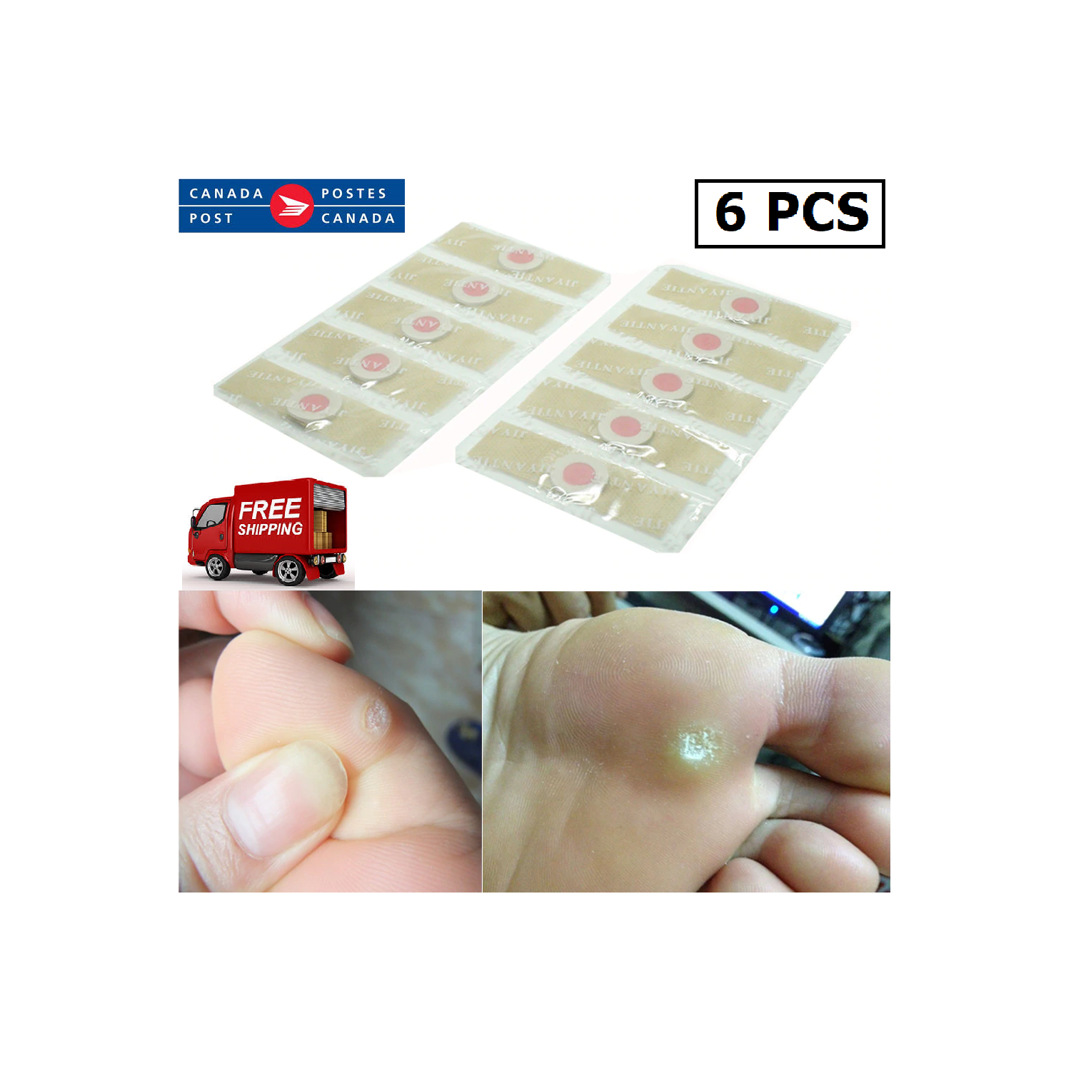 6Pcs Box Foot Corn Removal Plaster with Warts Thorn Patch Soften Skin Sticker