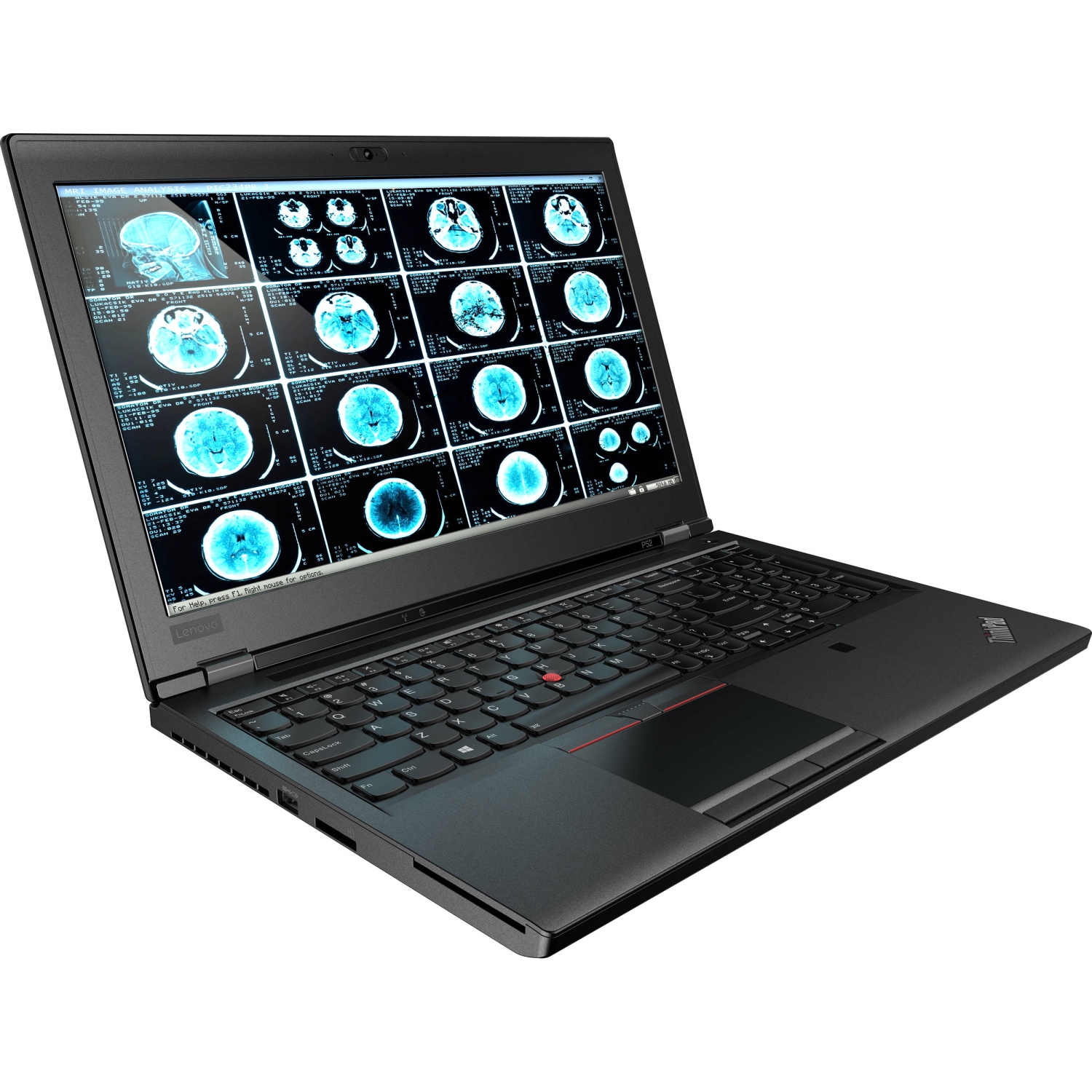 Refurbished (Good) - Lenovo Thinkpad P52 15.6" Laptop, Core i7-8850H, 32 GB DDR4, 512 GB NVMe SSD, Quadro P1000