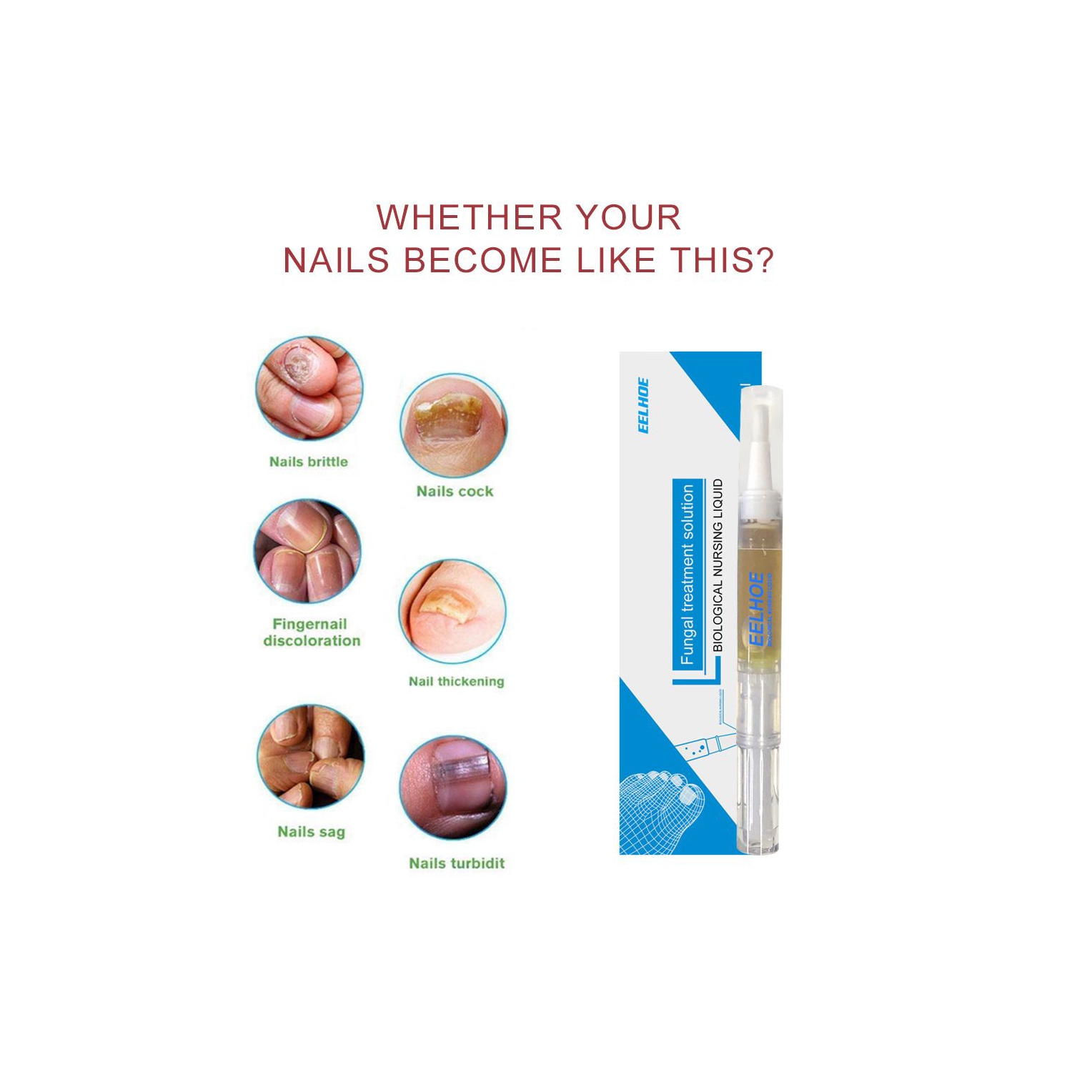 Anti-fungal Home Treatment Set Toe Nail Treatment Pen Onychomycosis Paronychia Anti Fungal Fungus Care Repair Serum Kit