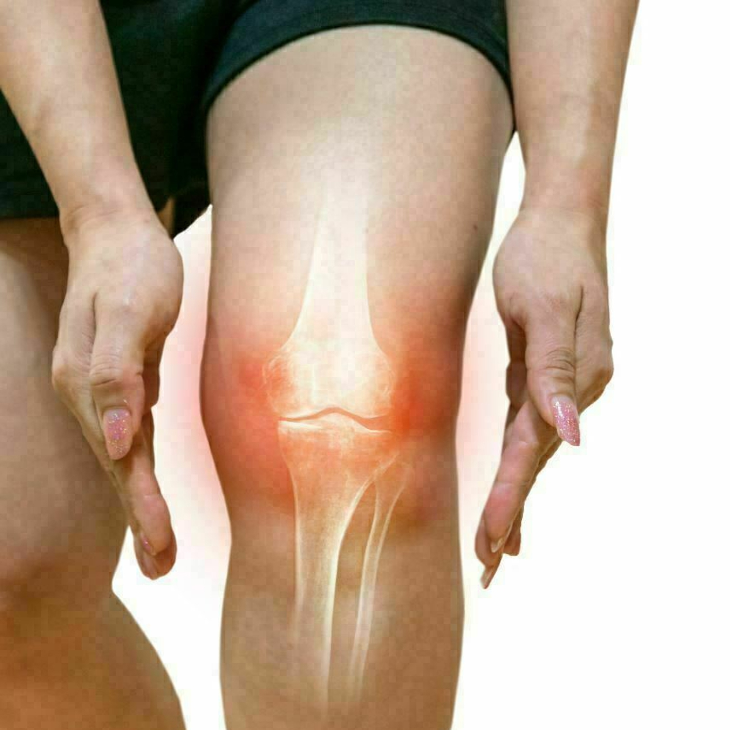 Knee Compression Sleeve Support for Men and Women, Knee Pads for Running, Hiking, Meniscus Tear, Arthritis, Joint Pain Relief