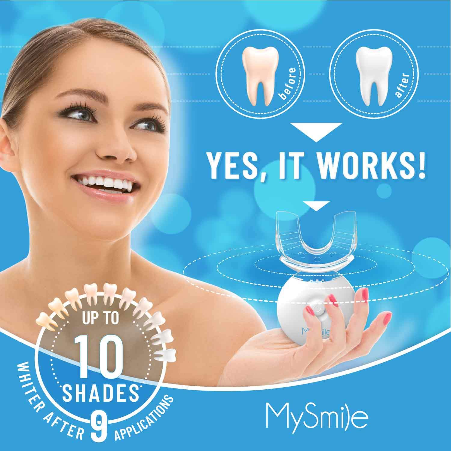 Kit de blanchiment des dents MySmile avec lumière DEL, blanchissant rapide sans sensibilité en 10 minutes avec 3 dents blanchissantes au peroxyde