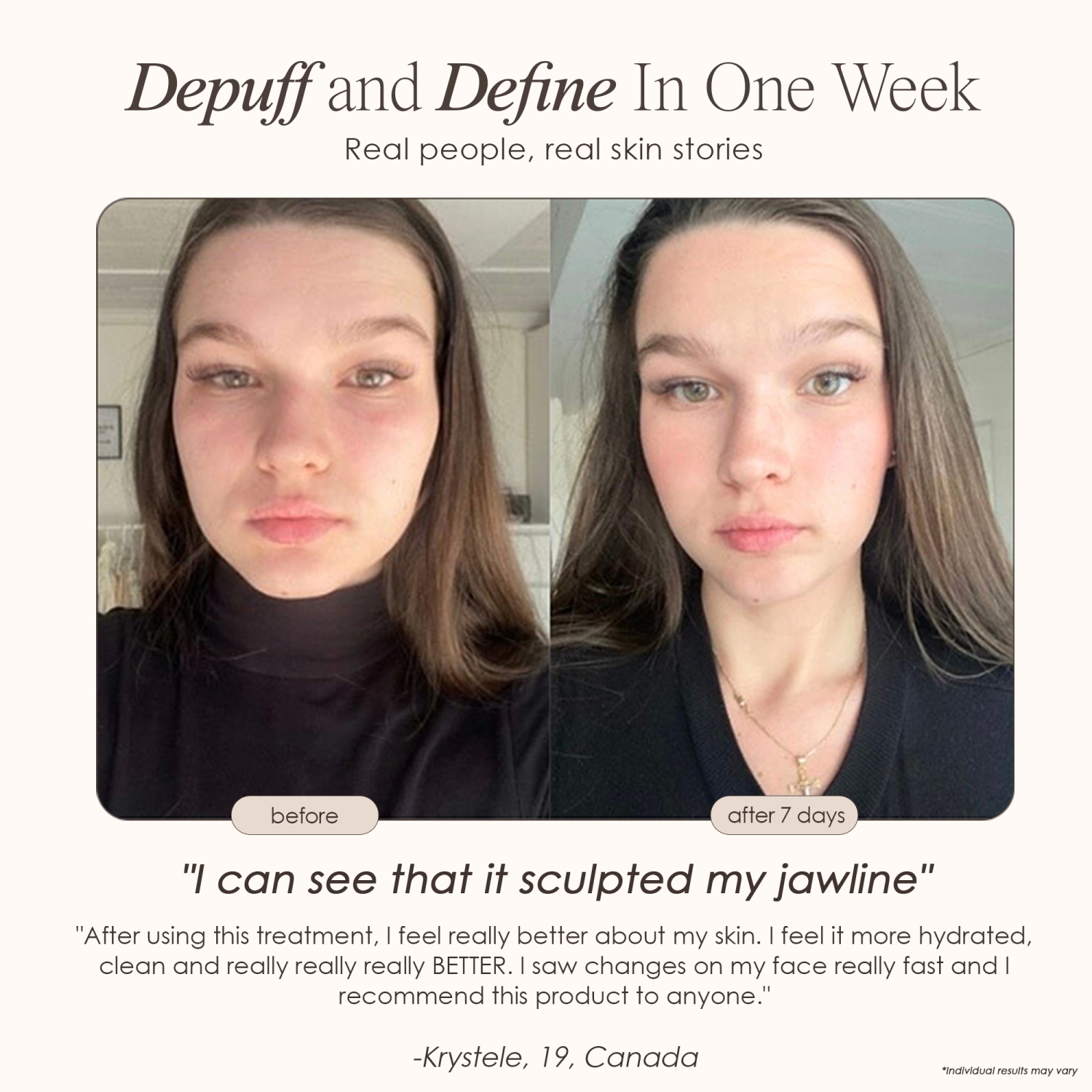 Project E Beauty The Ice Roller | Cryotherapy Treatment | Reduce Puffiness & Dark Circles | Tightens & Firms | Remove Wrinkles