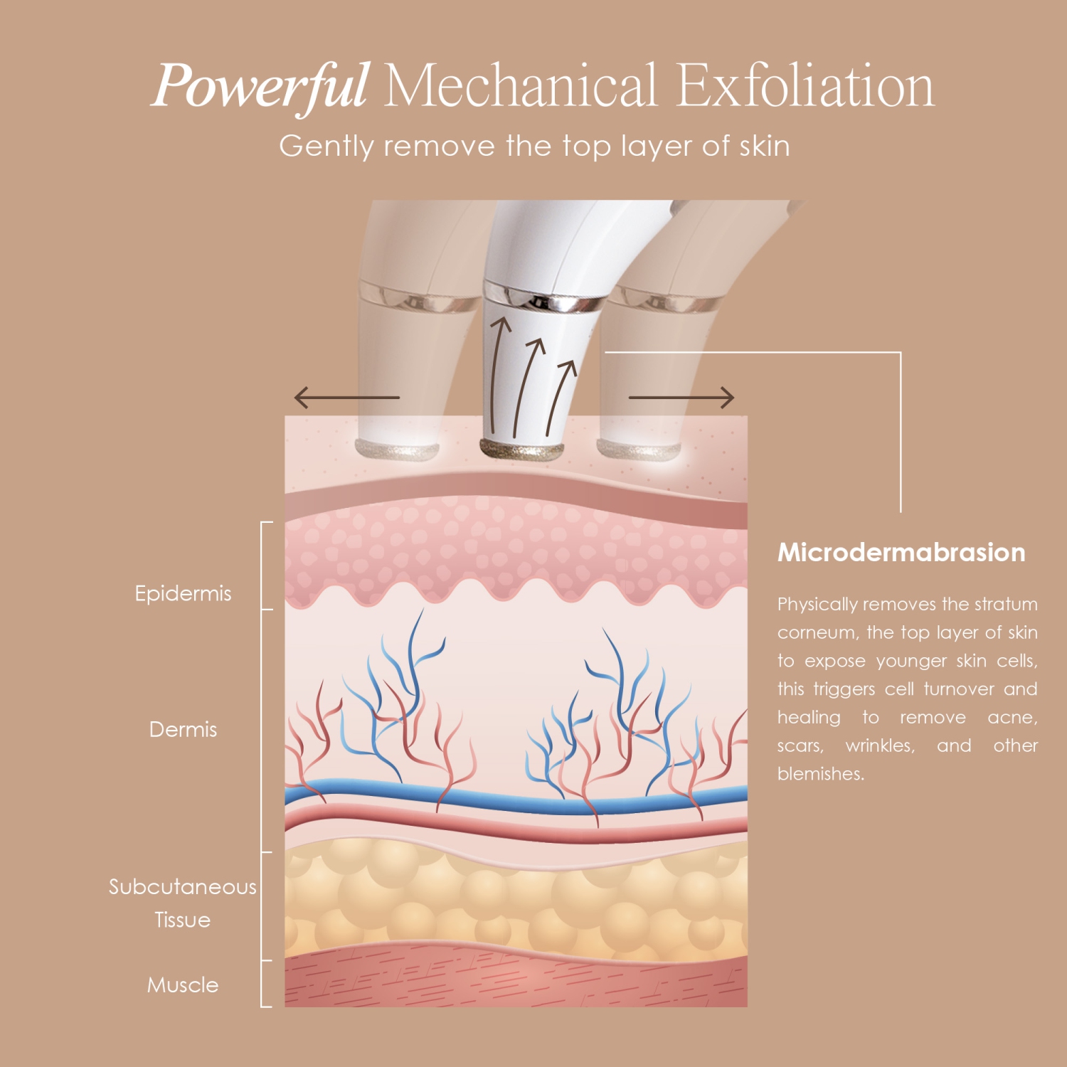 Project E Beauty Reinvo Facial Microdermabrasion Wand | Skin Renewal | Reduce Fine Lines & Wrinkles | Treat Sun Damage