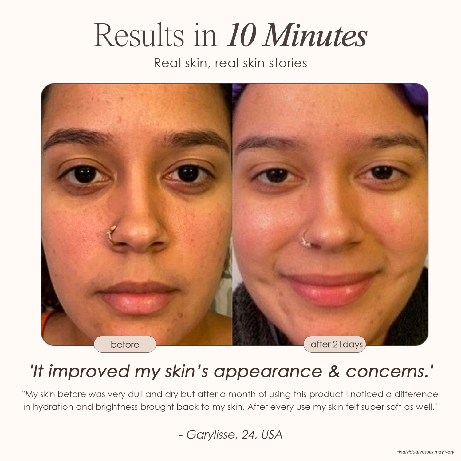 Project E Beauty Sensa Nano Ionic Facial Steamer | Pore Cleansing | Detoxify & Clarify | Moisturize & Hydrate | Aromatherapy