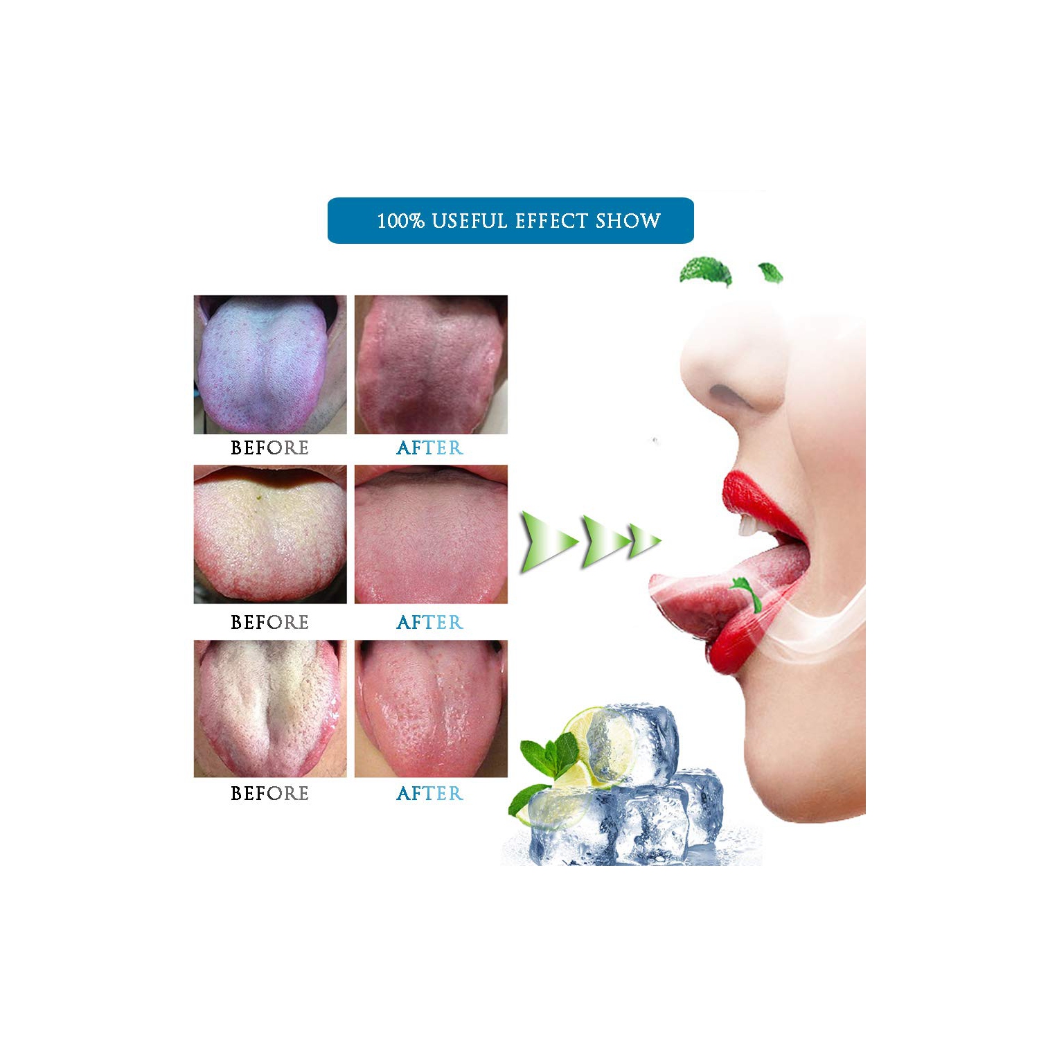 [Silicone souple] 3PCS Nettoyant pour grattoir à langue, racleurs oraux, ensembles de balais haut de gamme, outils pour la mauvaise haleine, trousses