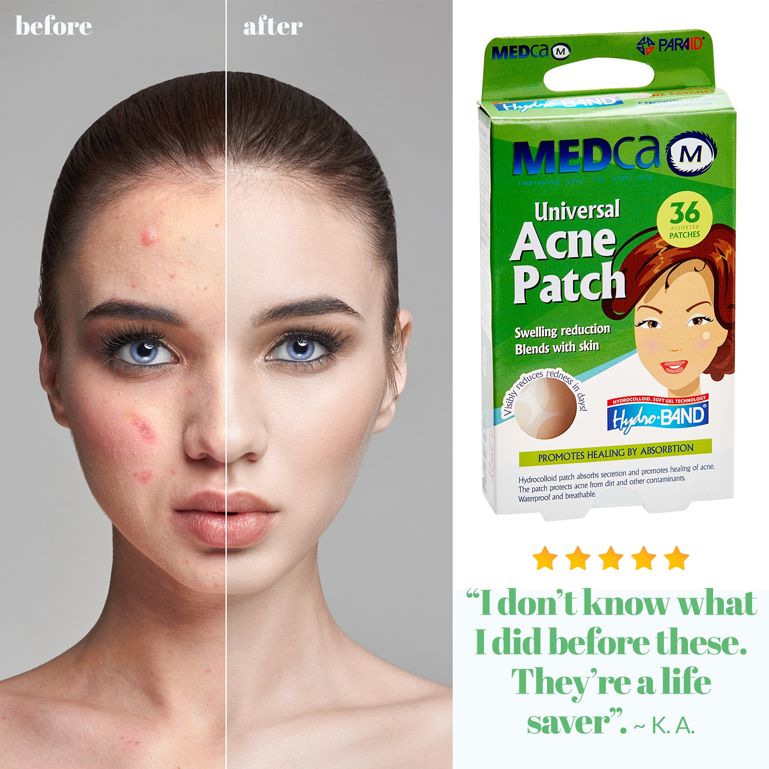 Acne Care Pimple Patch absorbante - pansements hydrocolloïdes deux tailles universelles, traitement Acne Spot pour face & Skin Spot Patch qui cache