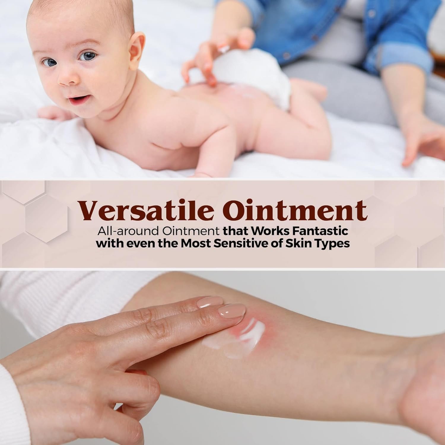 Onguent contre l'érythème fessier Medca Vitamin a & D – Crème protectrice pour peau sensible – Lanolin & Petrolatum, mains/pieds/visage craquelés à