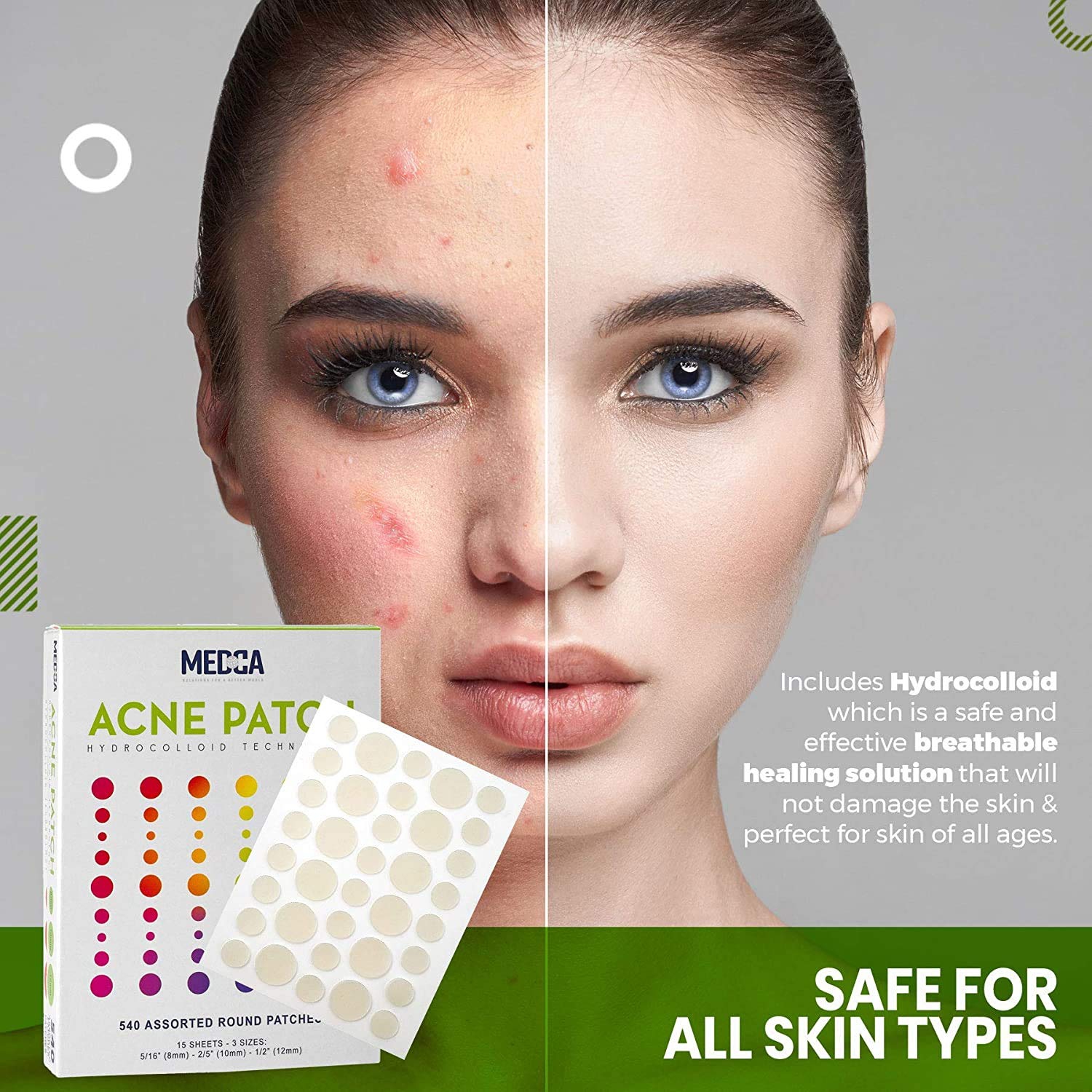 Taches d'acné pour le visage - pansement hydrocolloïde Pimple Patch in 3 Universal Size, Acne Spot Treatment Care for face & Skin Spot Patch, Acne,