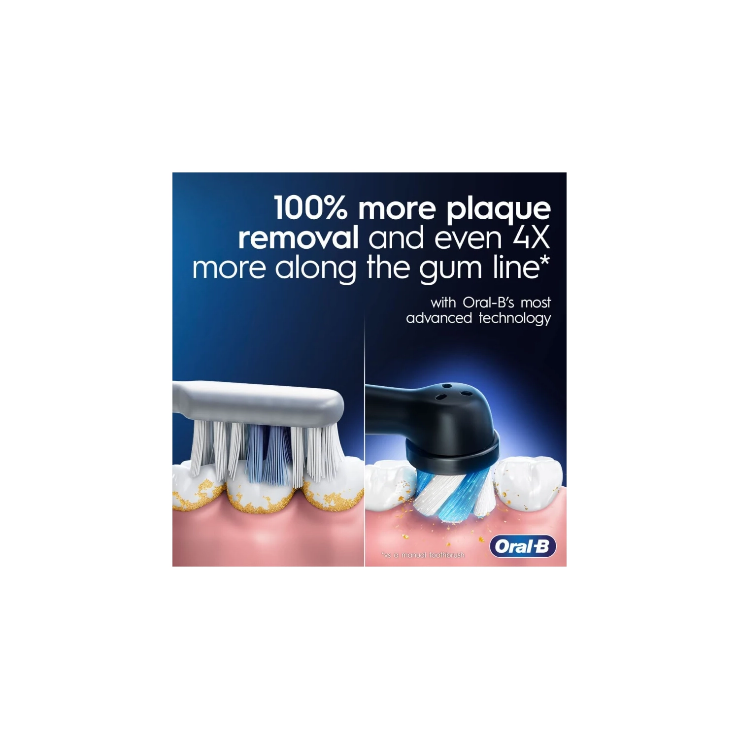 Oral-B Power iO Series 9 Electric Toothbrush - Black Onyx, Rechargeable with 4 Brush Heads and Charging Travel Case