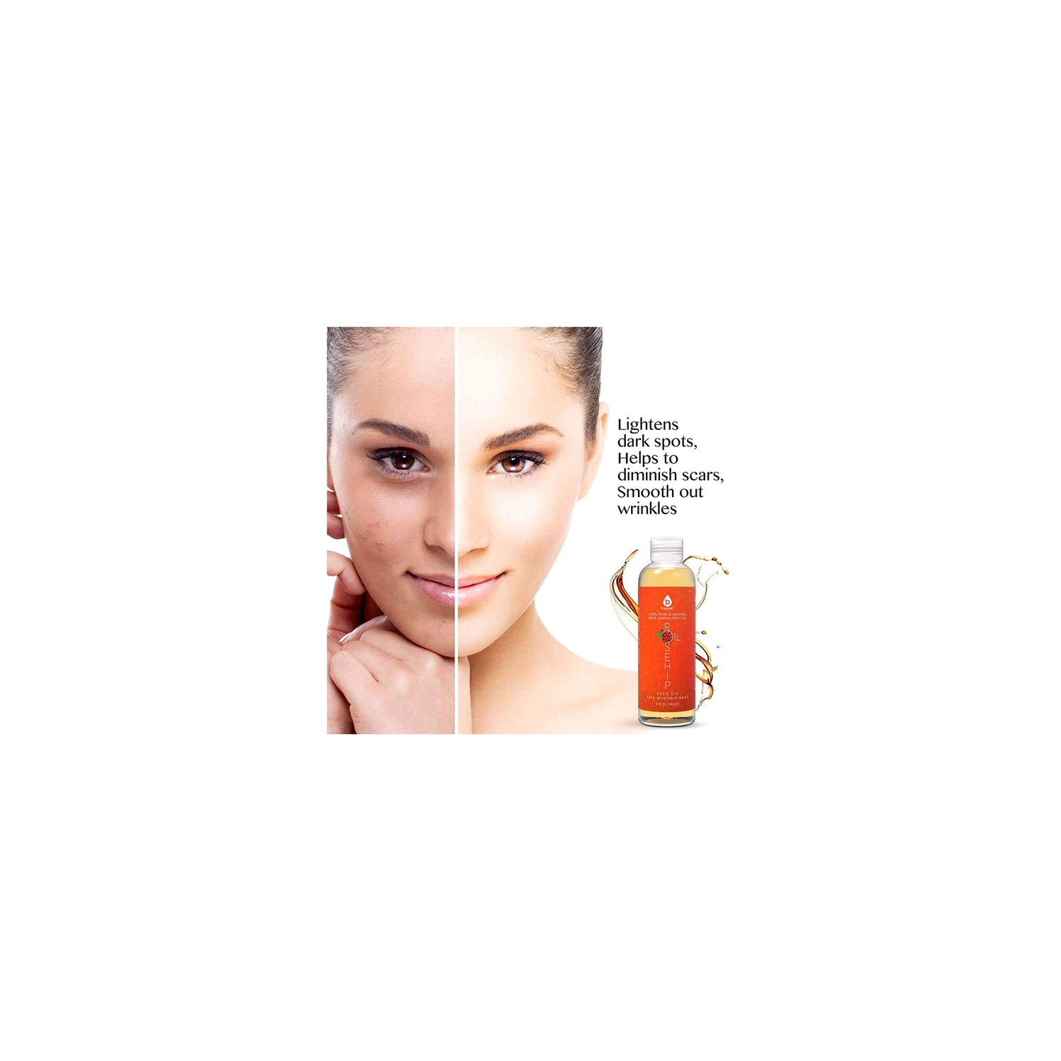 Huile Pure Rosehip 100 % de Pursonic, 6 oz