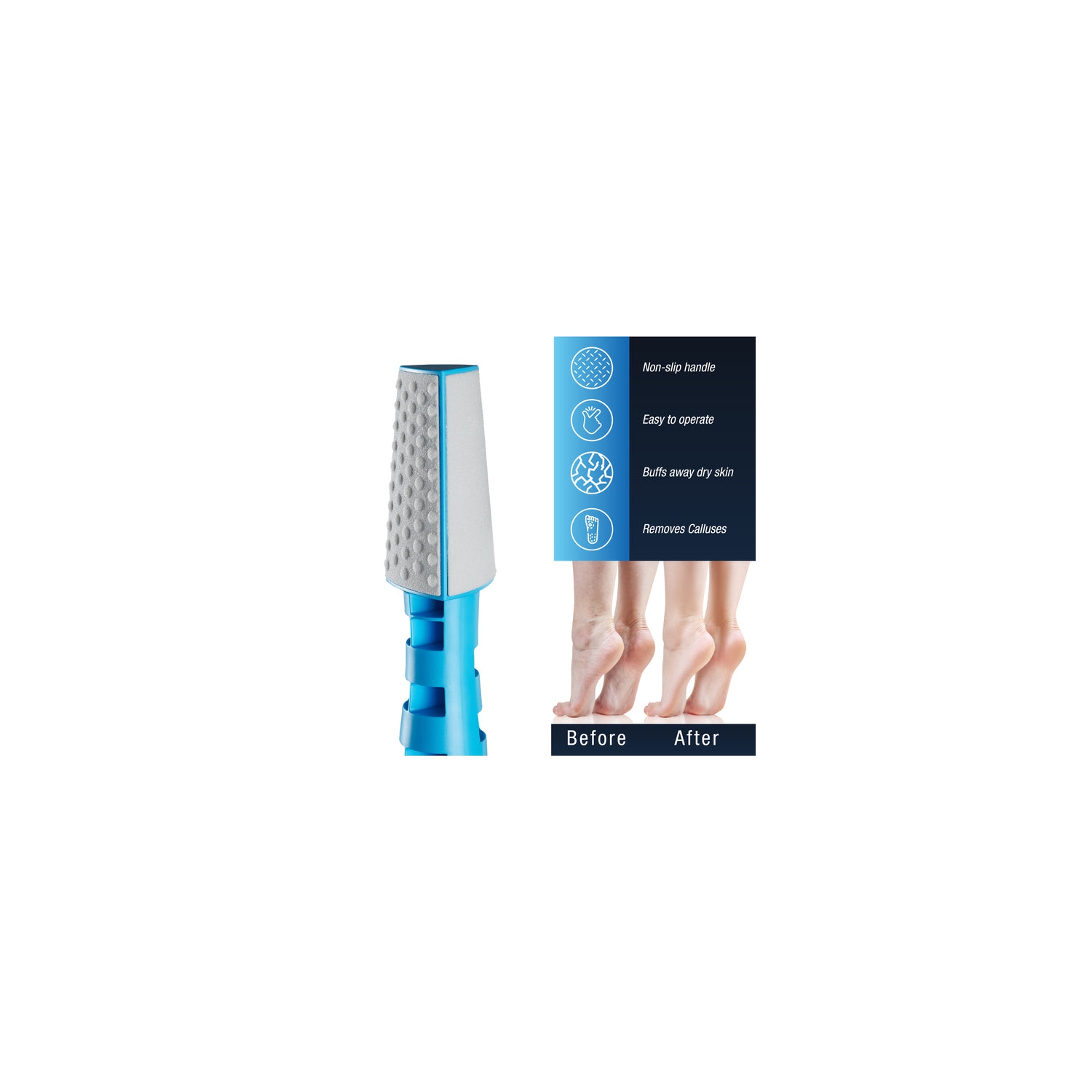 Pursonic 3 In 1 Callus Remover