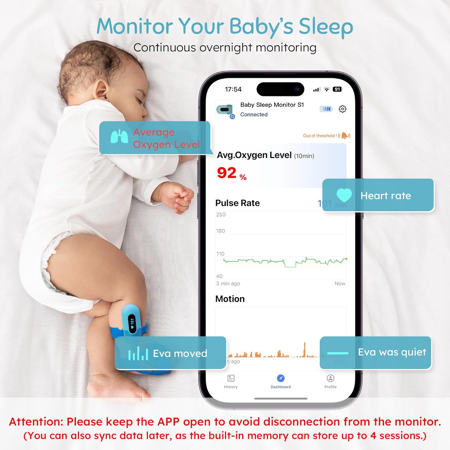 Interphone de surveillance à oxygène de Babytone, moniteur de sommeil de bébé, moyenne de suivi de O2, fréquence cardiaque et mouvement pour bébé,