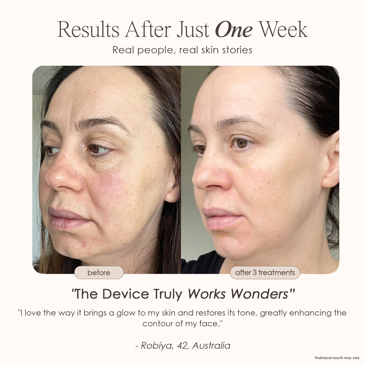 Project E Beauty REVA | Instant Age Renewal Wand | Anti-Aging Facial Massager | Skin Tightening & Lifting | Sculpting & Toning