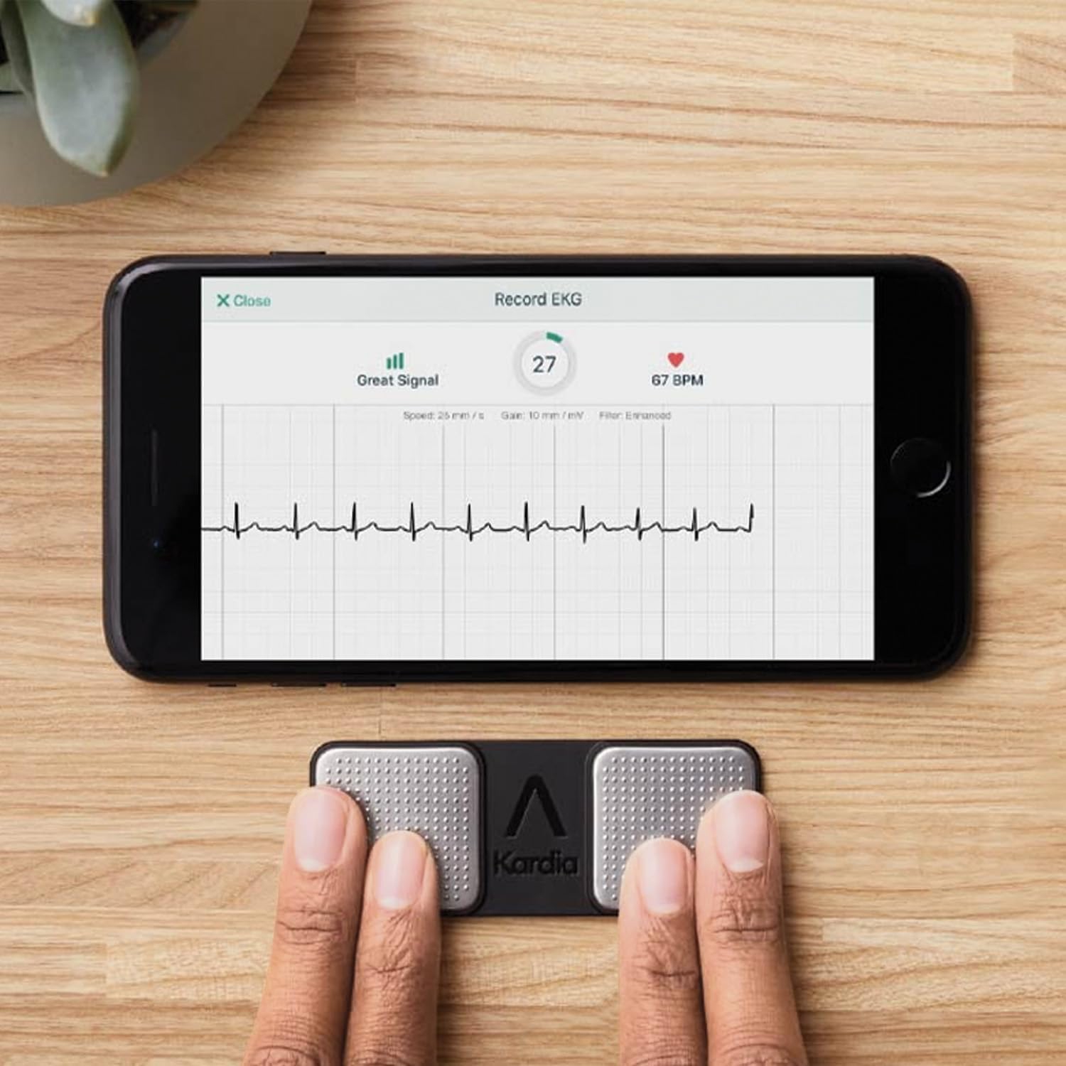 Moniteur ECG KardiaMobile | appareil ECG personnel sans fil | détecter l'fibrillation auriculaire à la maison en 30 secondes