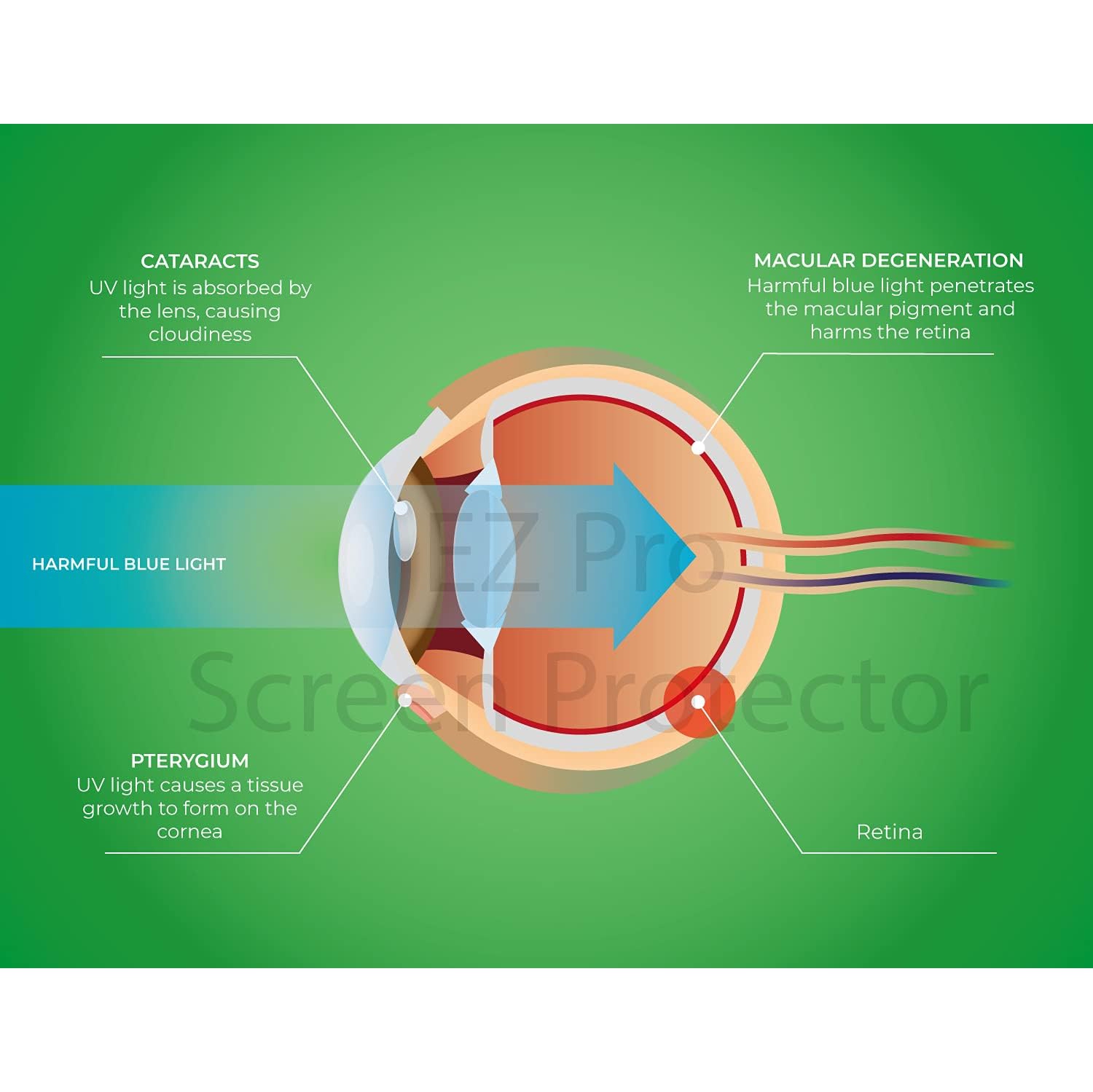 Premium Anti Blue Light and Anti Glare Screen Protector for 17.3 inches Laptop with Aspect Ratio 16:9. Easy