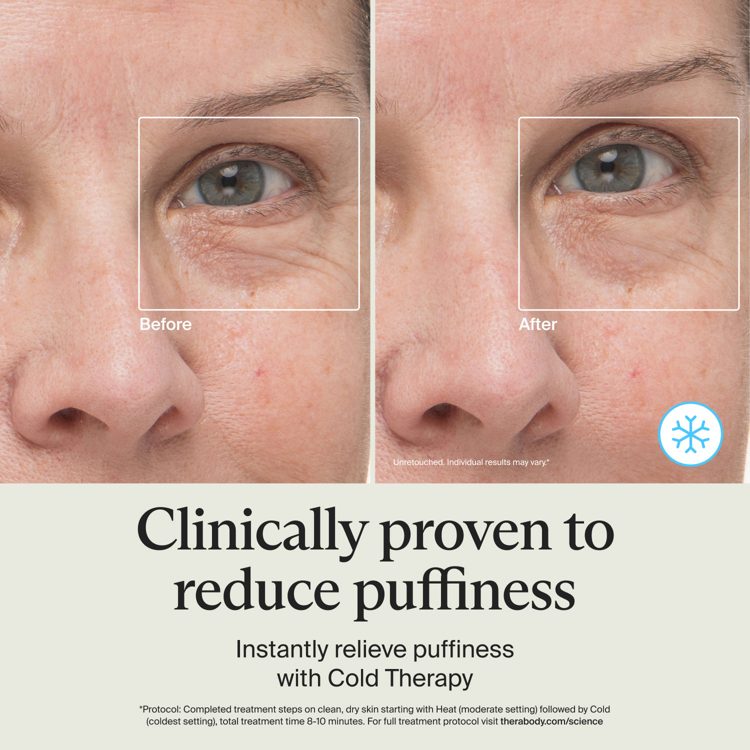 Bâton lissant Theraface de Therabody - Blanc