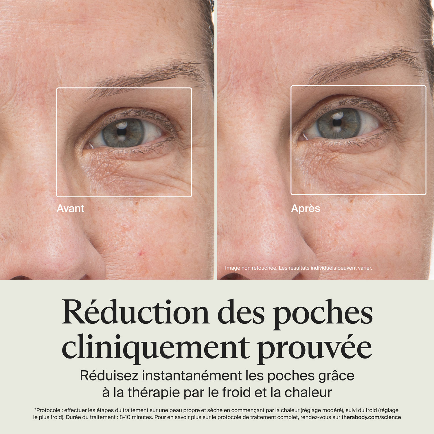 Bâton lissant Theraface de Therabody - Blanc