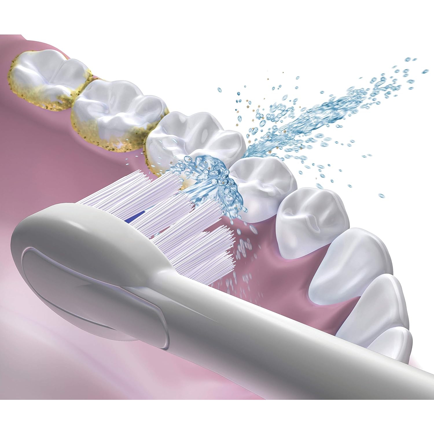 Têtes de brossage de rechange compactes Sonic-Fusion™ de Waterpik™ - Paquet de 2