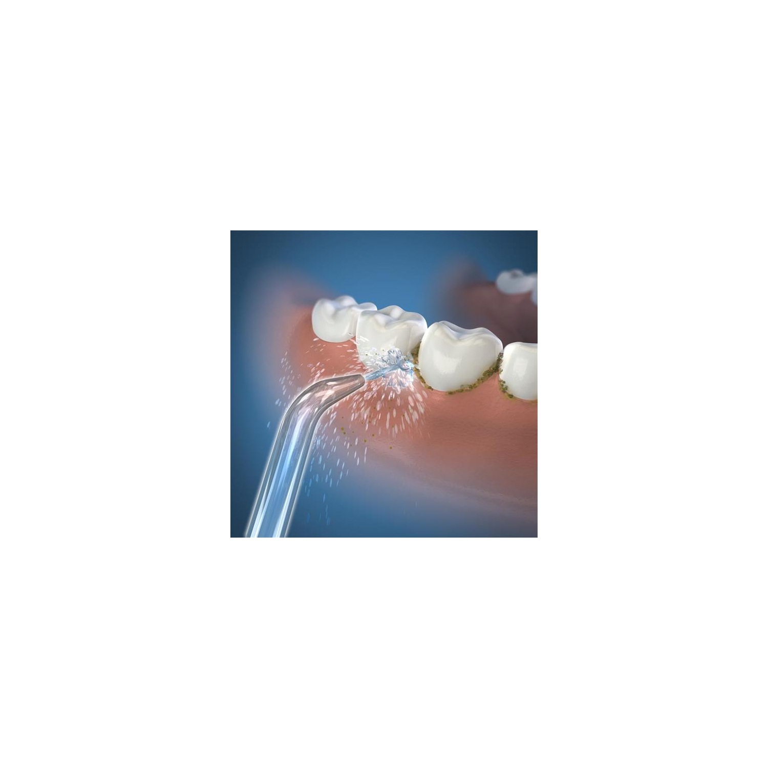 Waterpik™ Jet Tips - Pack of 2