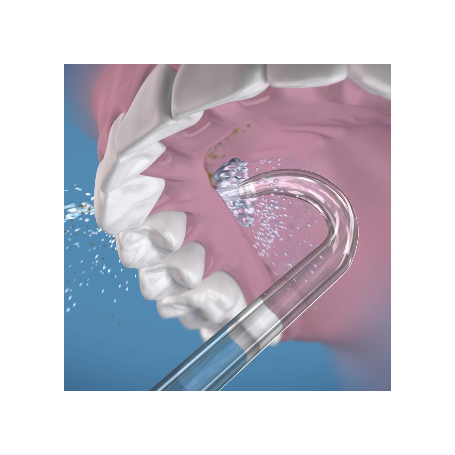 Waterpik™ Denture Flosser Tips - Pack of 2