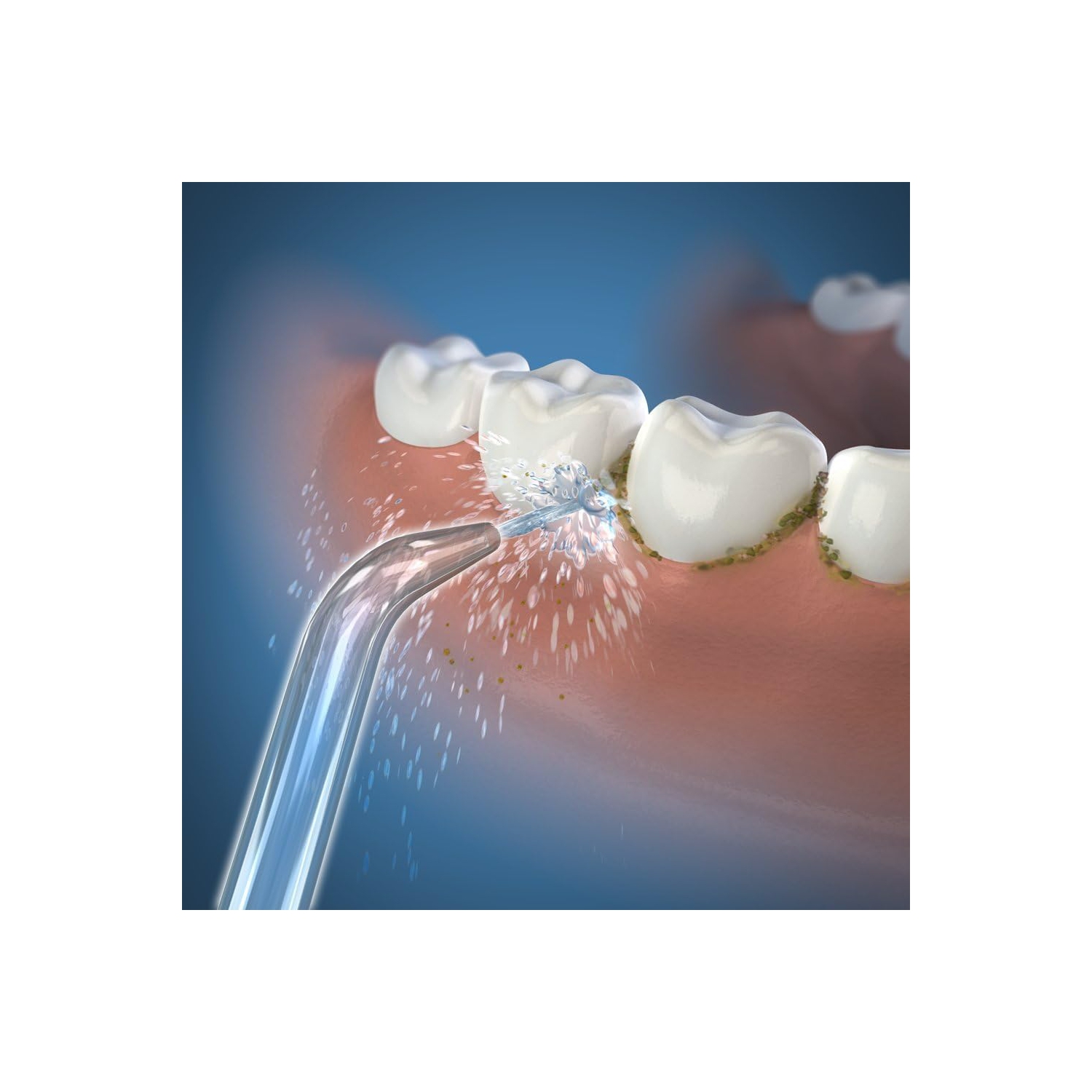 Waterpik™ Classic High Pressure Jet Tips - Pack of 2