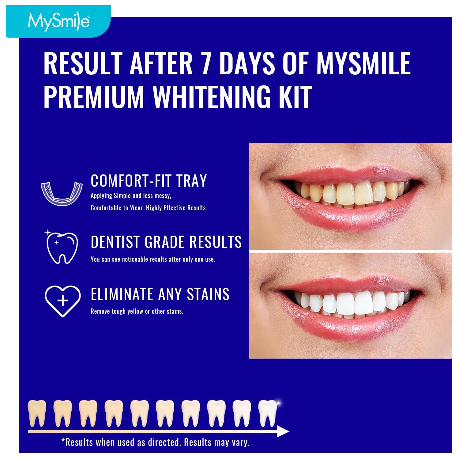MySmile Prefilled Teeth Whitening Trays Kit, 12% Hydrogen Peroxide, Non-Liquid Gel Technology Tooth Whitening Trays, Whiten Teeth Faster, 7X