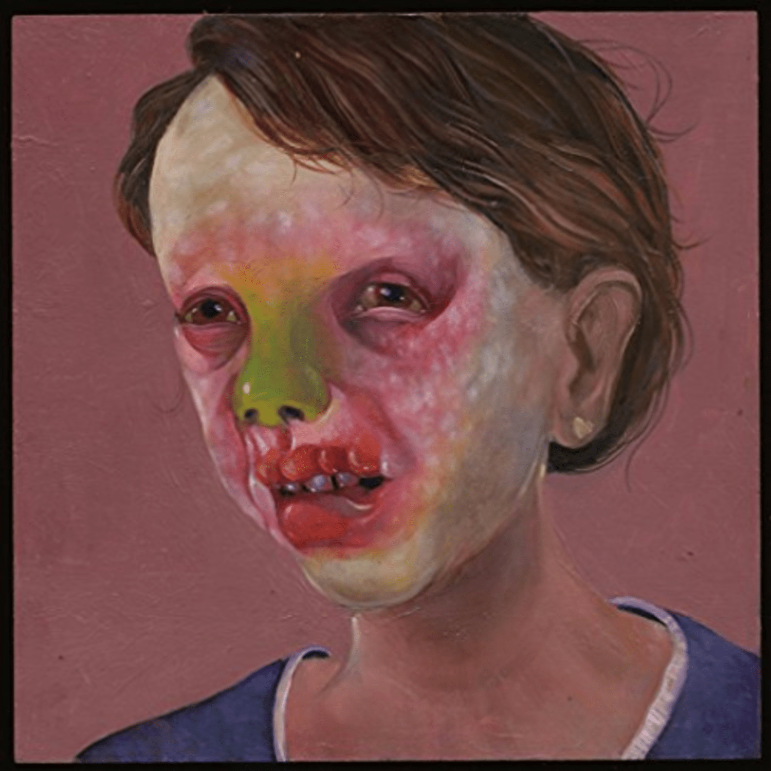 Controlled Bleeding - Larva Lumps & Baby Bumps - - [Vinyl]