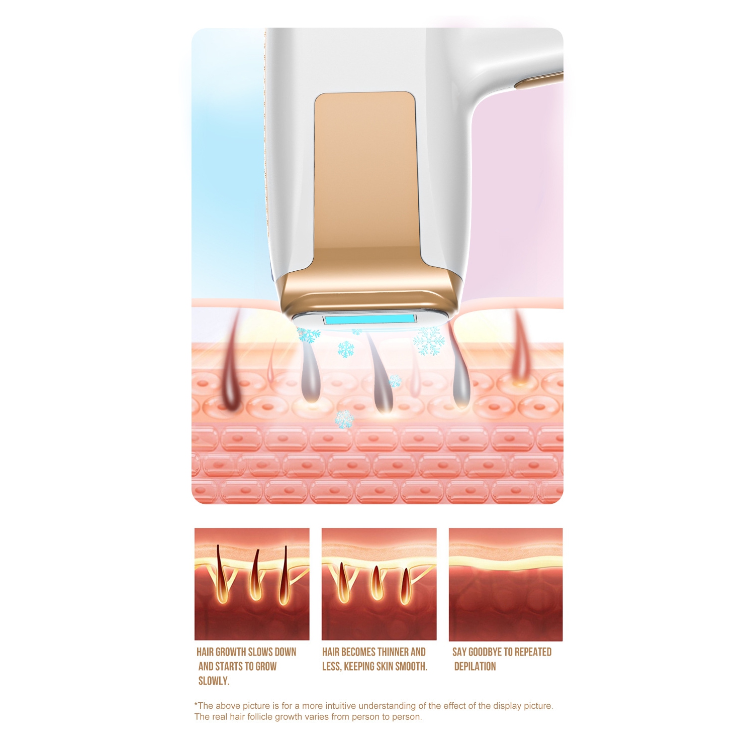 Freezing Point Painless Hair Shaver Strong Pulse Epilator IPL Hair Removal Device Laser Epilator for Home Use-White