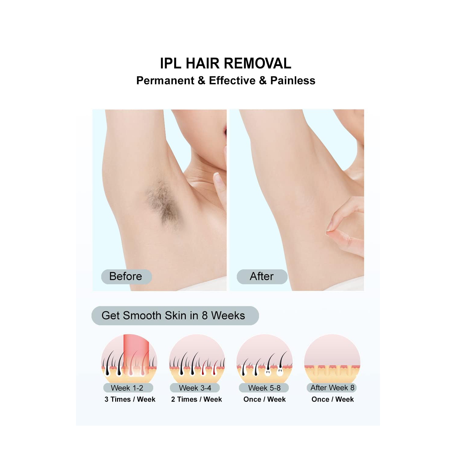 Épilation IPL, épilation laser à la maison pour femmes hommes, appareil d'épilation pour les jambes faciales Bras Bikini Line-White