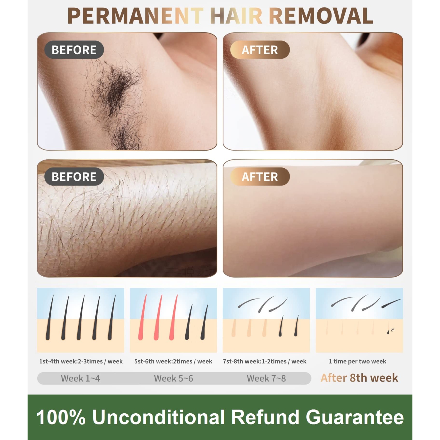 Appareil d'épilation laser IPL Dispositif d'épilation permanent sans douleur réduisant la repousse des cheveux appropriée pour une utilisation à