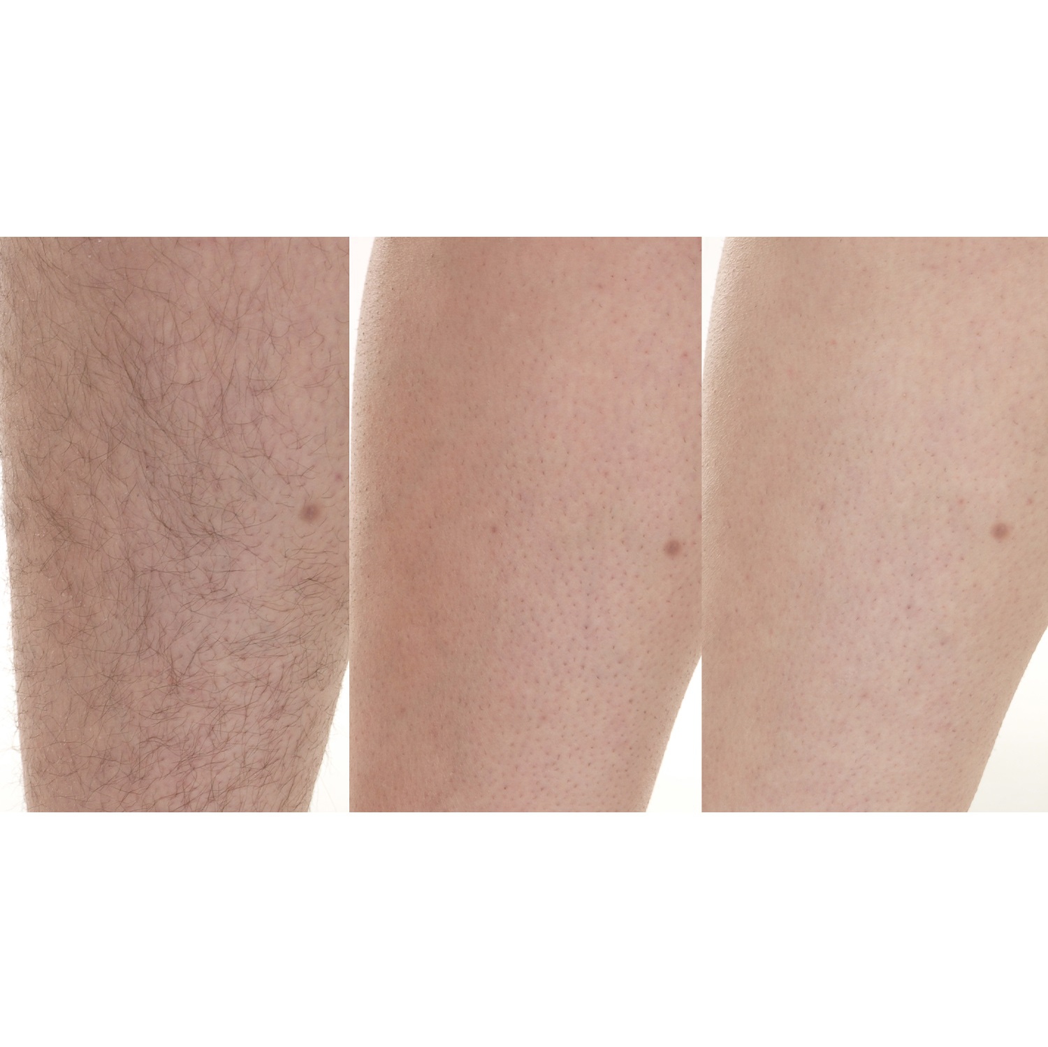 Silk'n Flash&Go Jewel Hair Removal Device