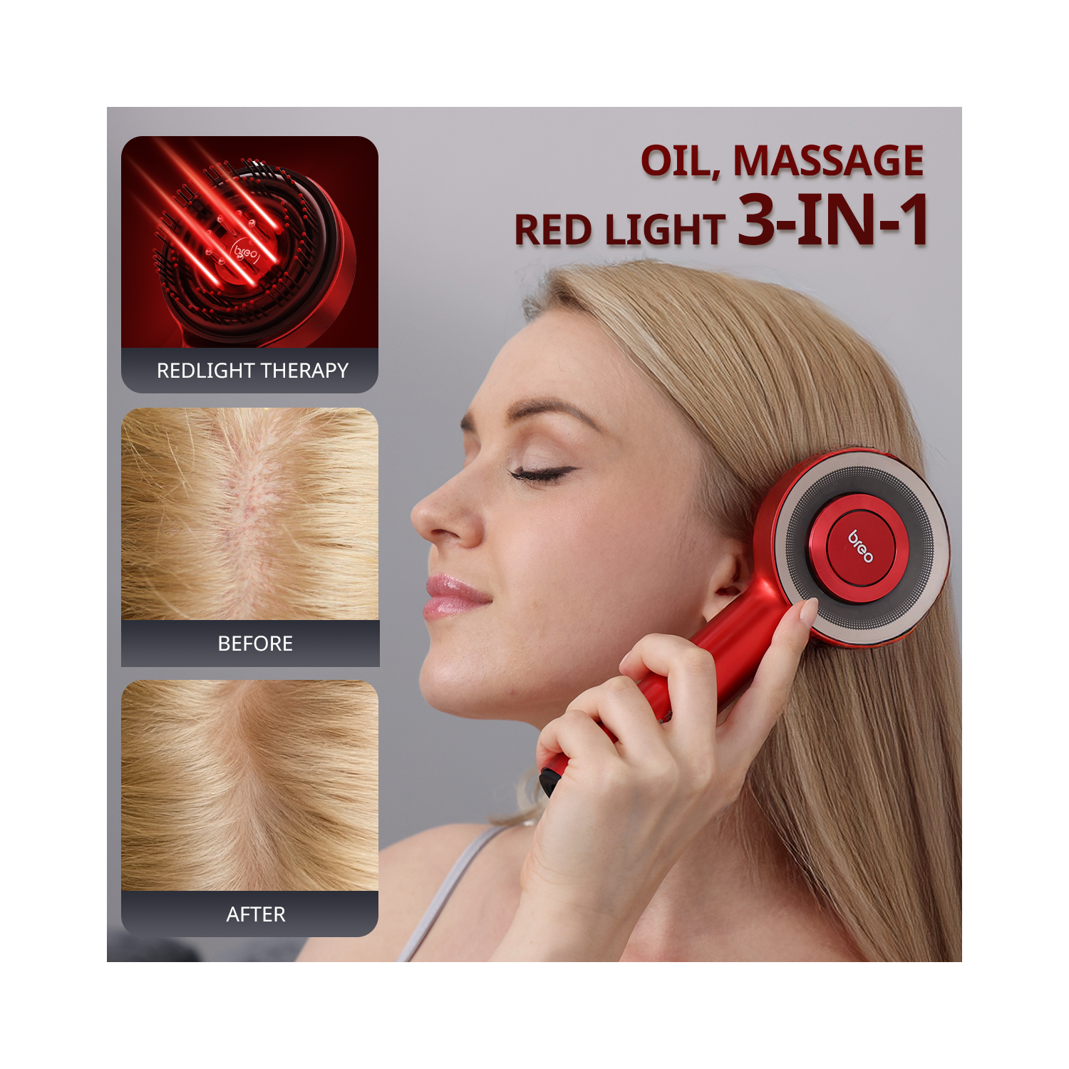 Breo Scalp3 Scalp Massager Comb Anti Hair Loss Scalp Massaging brush Hair Growth Care Scalp Hair Therapy Scalp Reduction Redlight Infrared Therapy