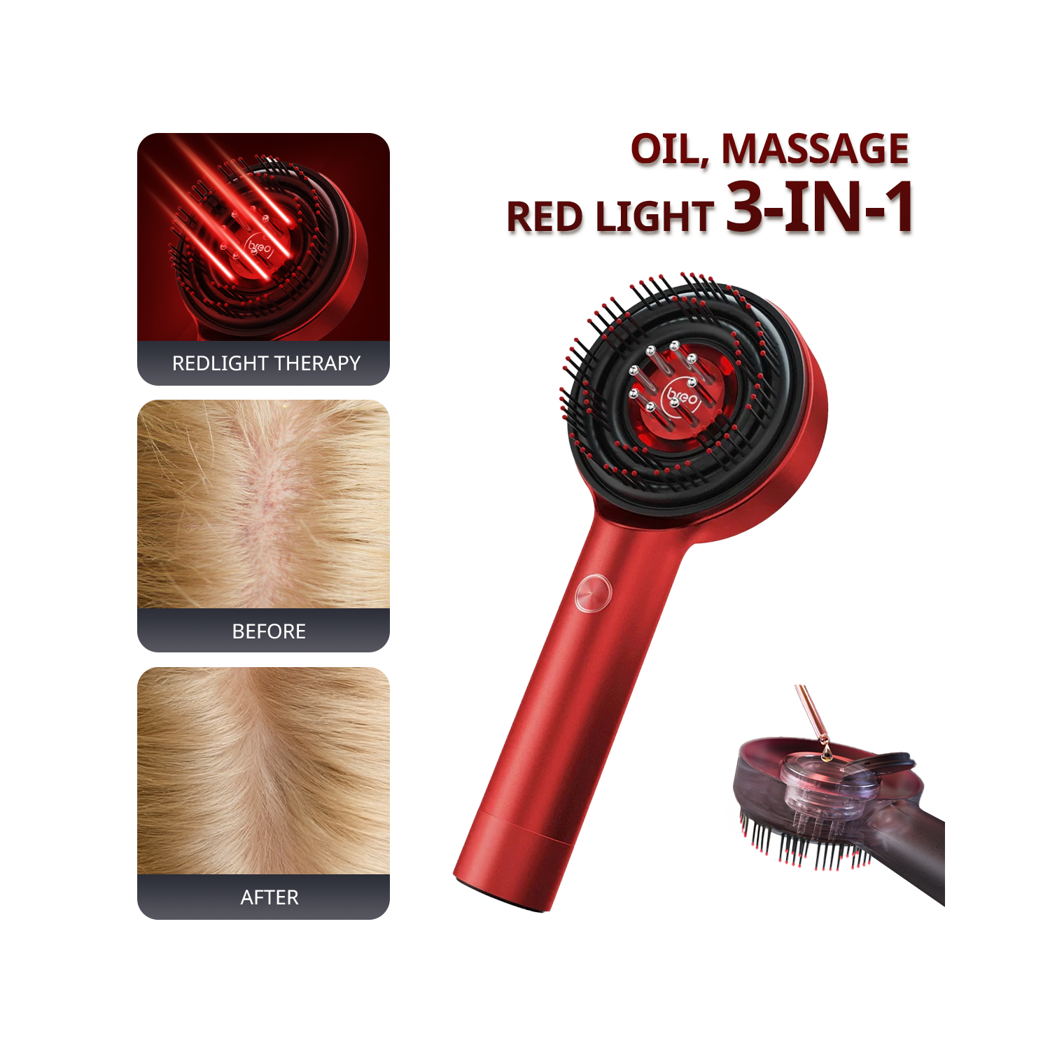 Breo Scalp3 Scalp Massager Comb Anti Hair Loss Scalp Massaging brush Hair Growth Care Scalp Hair Therapy Scalp Reduction Redlight Infrared Therapy