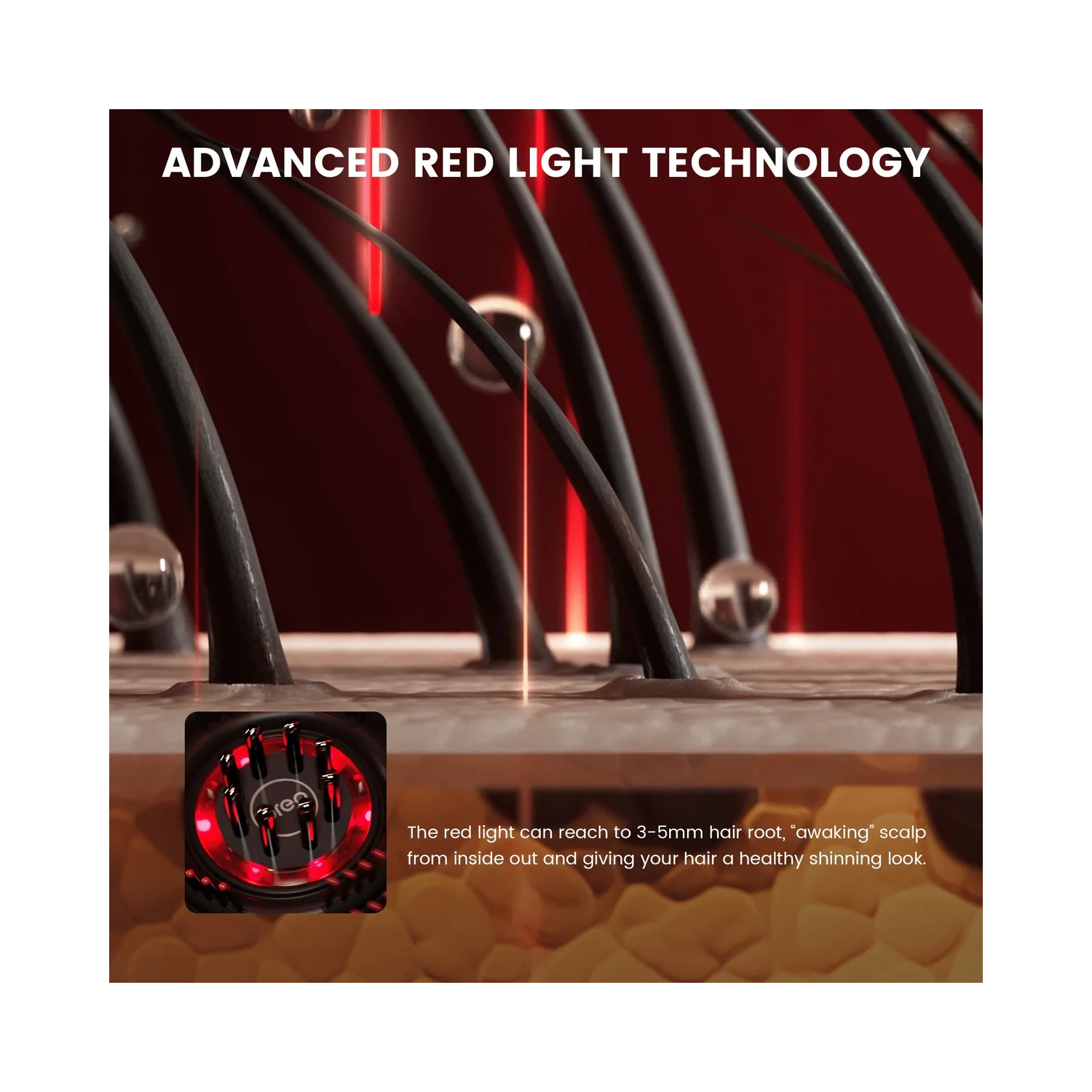 Breo Scalp3 Scalp Massager Comb Anti Hair Loss Scalp Massaging brush Hair Growth Care Scalp Hair Therapy Scalp Reduction Redlight Infrared Therapy