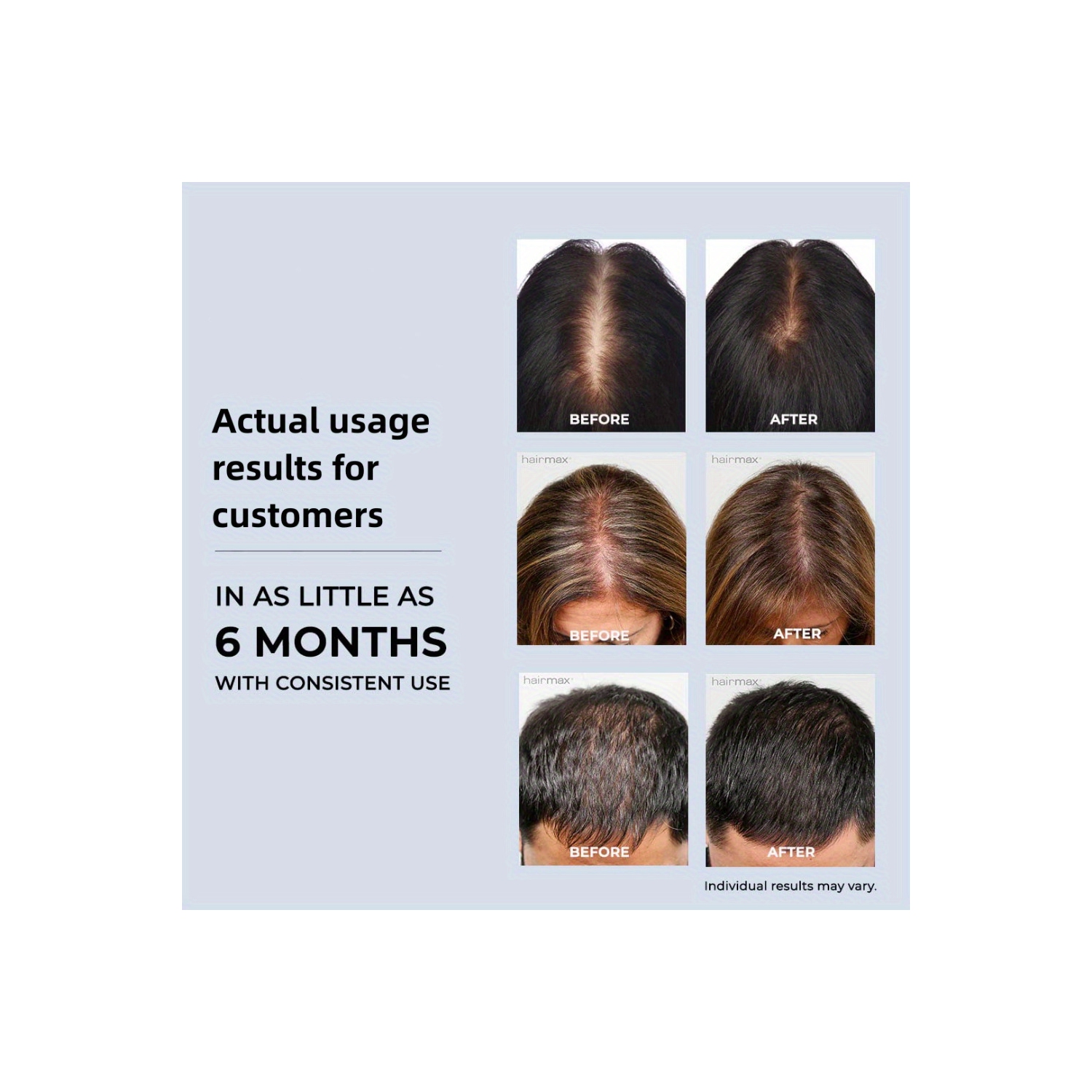 Laser Hair Growth Cap,Red Light Therapy Cap for Hair Loss,Hair Growth Hat,Anti-Loss Hair Cap for Men & Women