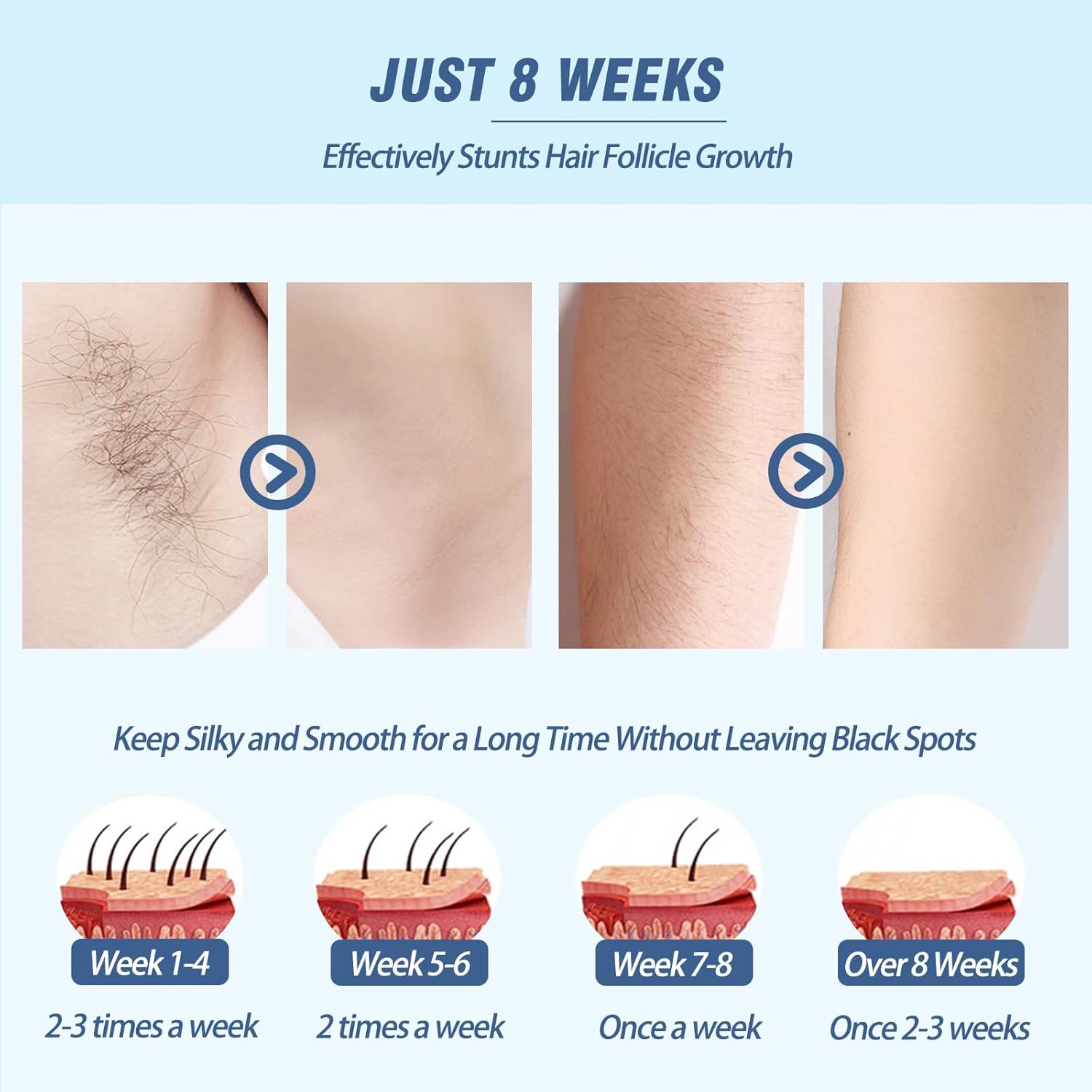 Épilation laser pour femmes hommes, appareil d'épilation IPL pour la maison avec 5 niveaux, mini démaquillant sans douleur pour le corps et le visage