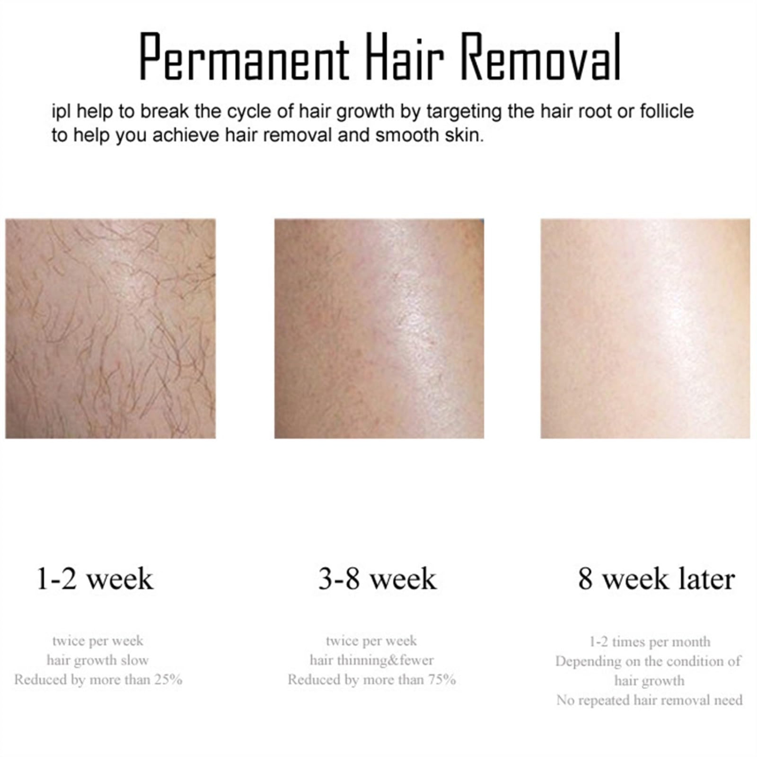 Épilateur 4-en-1 de bikinis rafraîchissant sans douleur avec laser , épilateur IPL sans fil d'épilateur laser