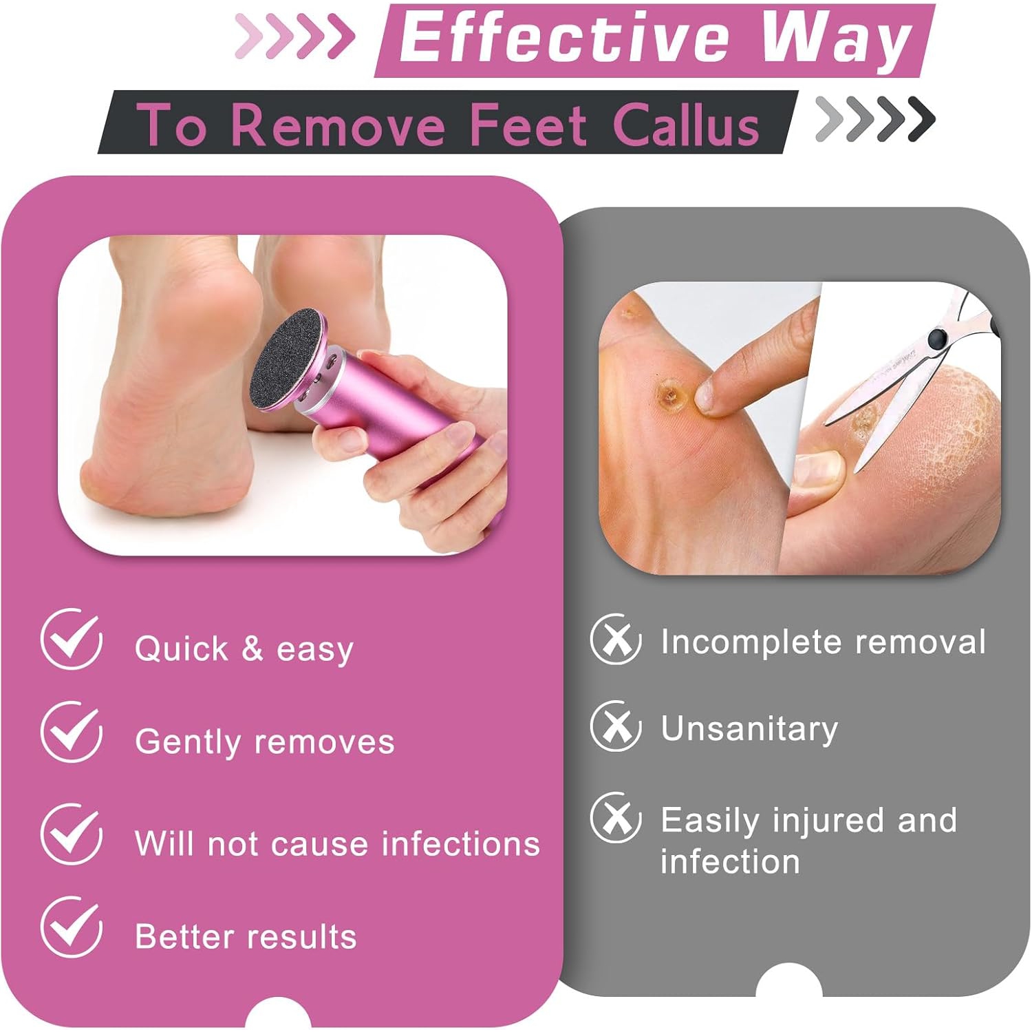 Electric Callus Remover, Foot Nail File Grinder Tool with Speed Controller and 60PCS Replacement Sandpaper Disk, Pedicure Tool Feet Scrubber for Dead