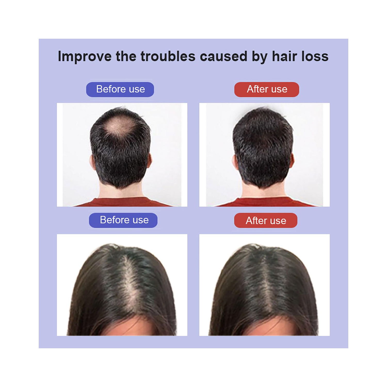 Red Light Therapy Cap for Hair ,Red Light Therapy for Hair Loss,Hair Loss Treatments Hat for Men & Women ,90W Lamp Beads