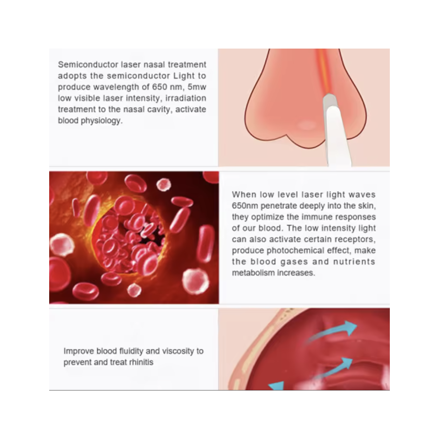 Thérapie nasale à lumière rouge pour nez Appareil de thérapie nasale à infrarouge rechargeable portative pour nez