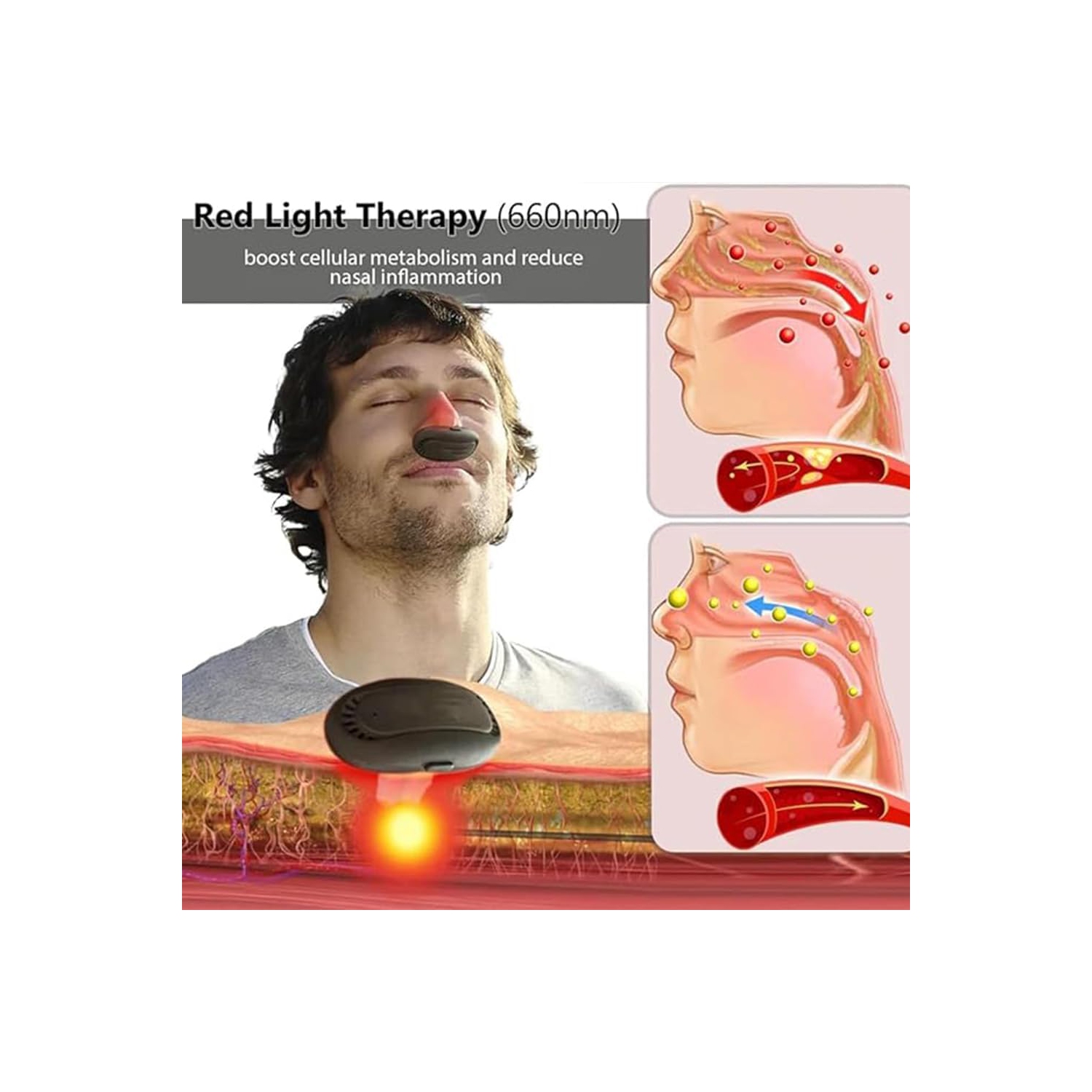 Dispositif de thérapie nasale Red Light Appareil apaisant nasal externe pour rhinite à lumière infrarouge