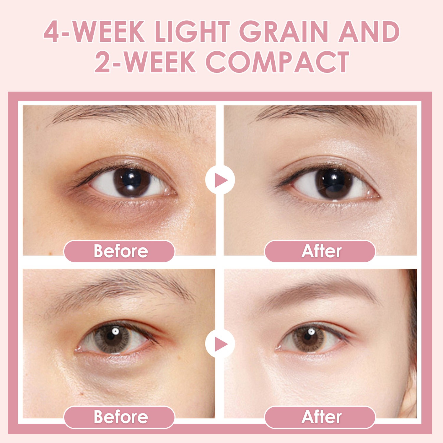 Vendre à succès EMS Micro-courant Hot Compress Lighten Dark Circles Electric Eye Skin incare Wand Anti Aging Therapy Eye Massager pour les yeux