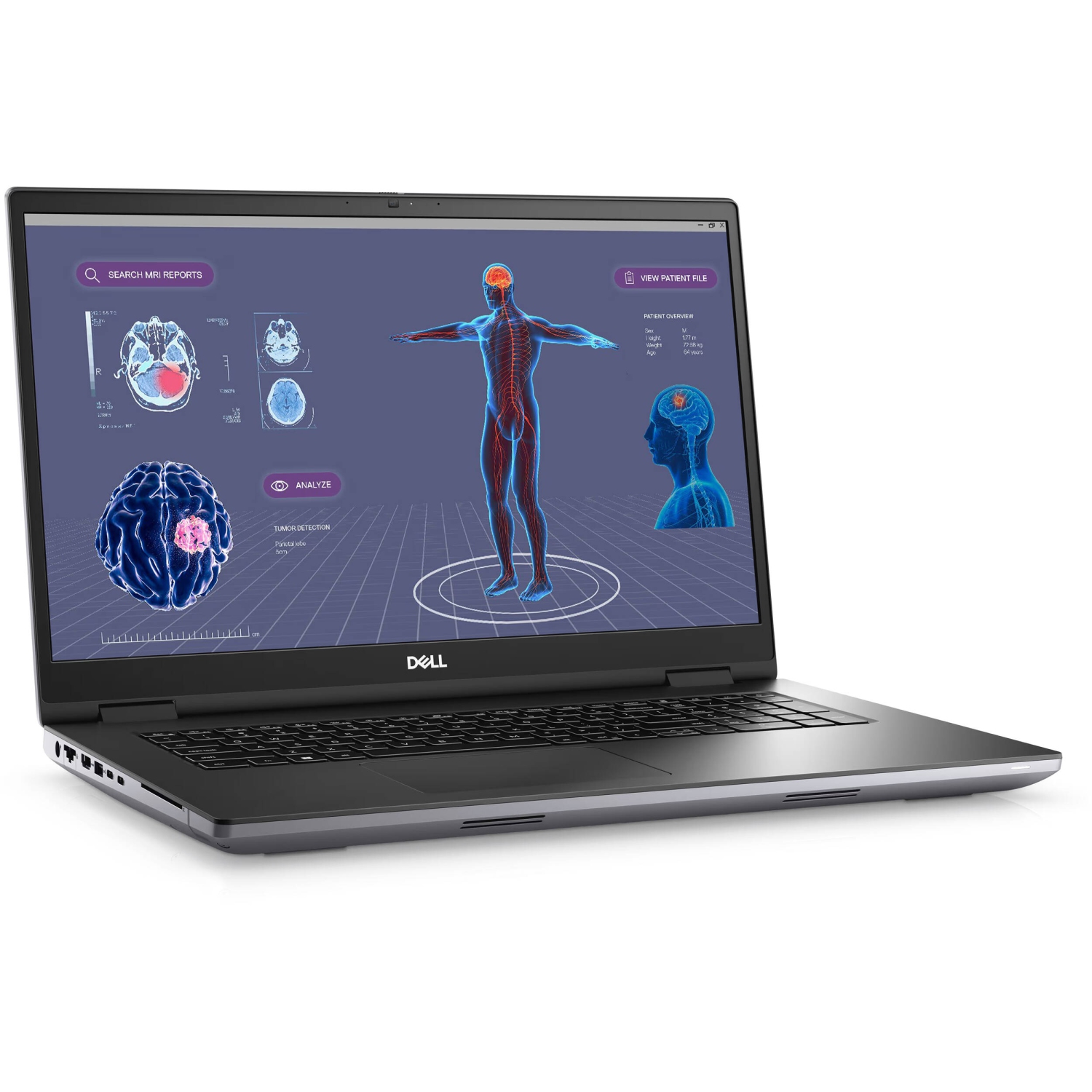 Refurbished (Excellent) - Dell Precision 7550 15.6" Workstation Laptop - 3840x2160(Intel Core I9-10885H/64GB RAM/1TB NVMe/Win 10)Like New