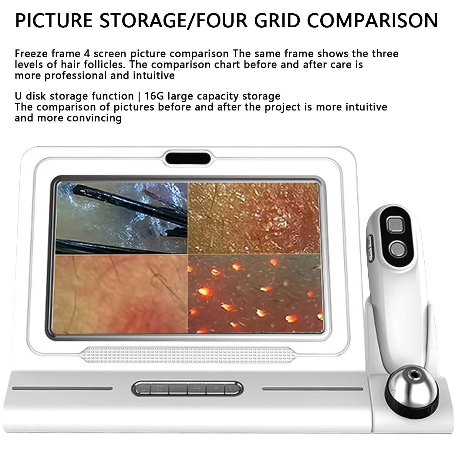 Skin Diagnosis Hair Analyzer,11-inch Skin Scalp Detector MultiFunctional Hair Follicle Analyser Machine,with 50x/200x Dual Heads,Skin & Scalp Health