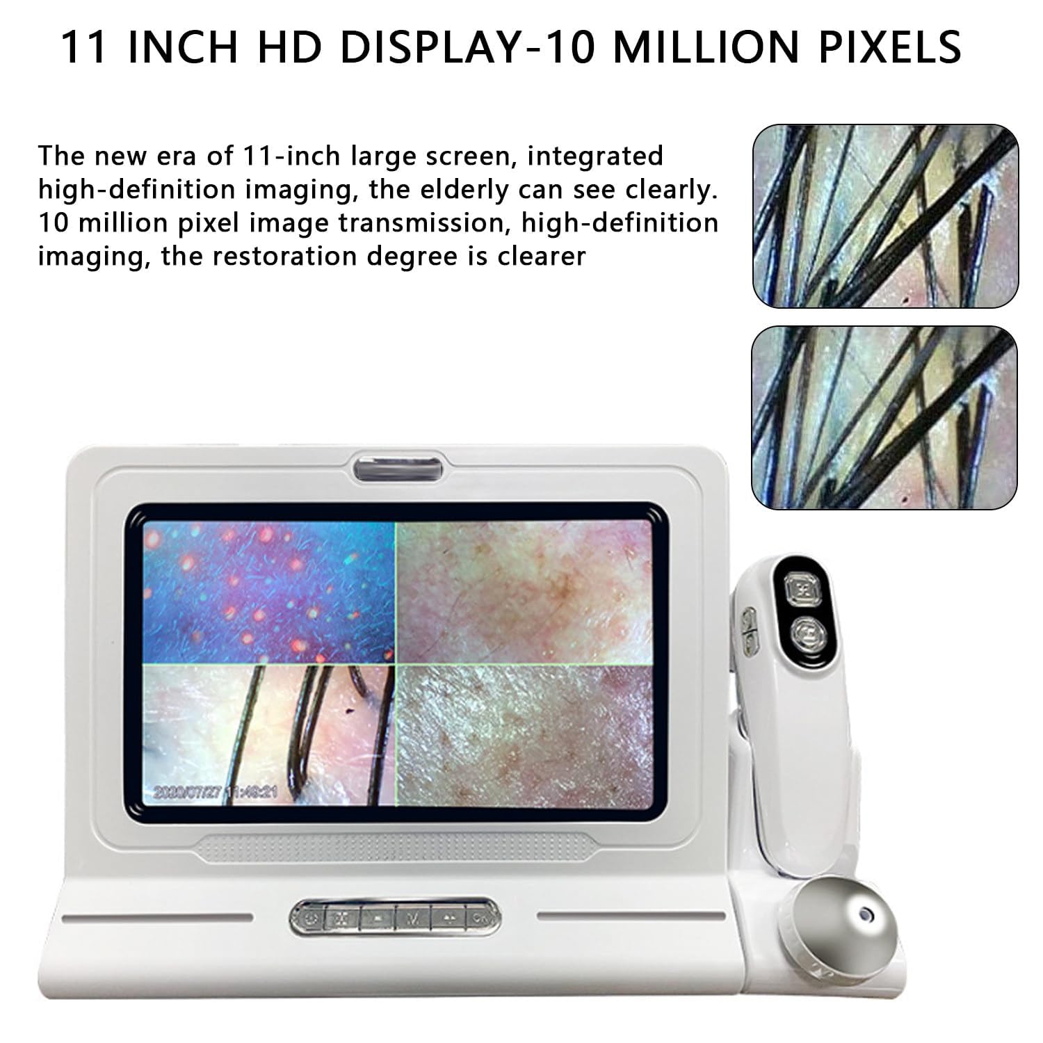 Skin Diagnosis Hair Analyzer,11-inch Skin Scalp Detector MultiFunctional Hair Follicle Analyser Machine,with 50x/200x Dual Heads,Skin & Scalp Health